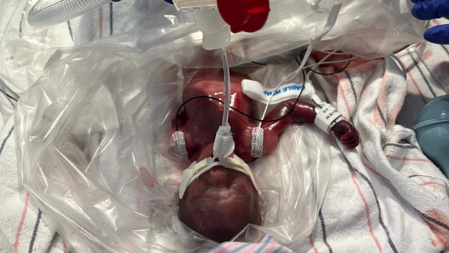 A Early Blessing photo