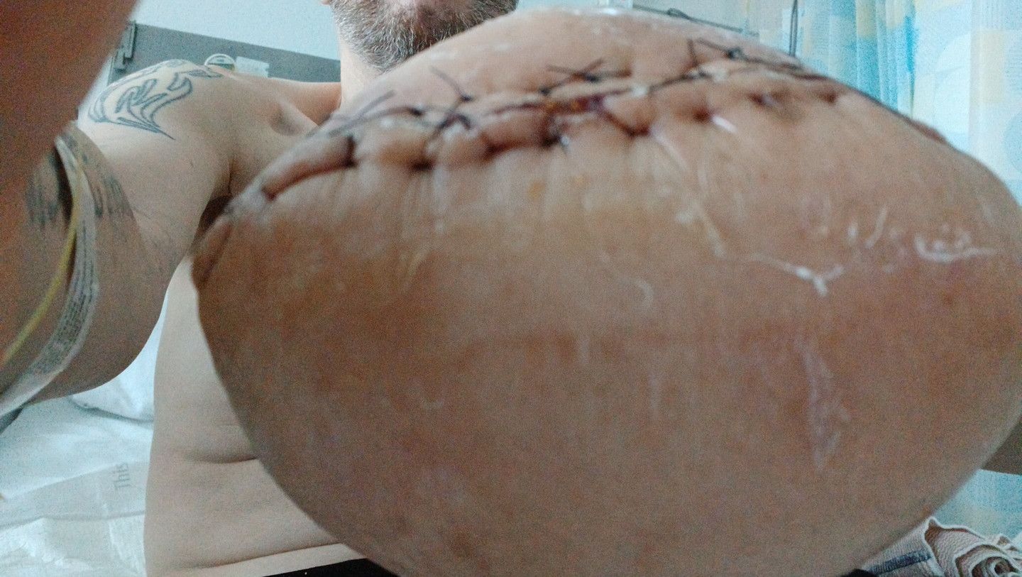 Help David Rebuild After Train Accident photo