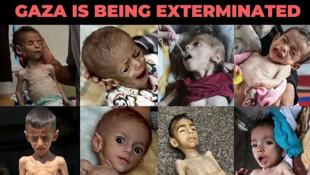 Urgent Humanitarian Appeal: Save Ibrahim's life in Gaza❤ pinned link photo