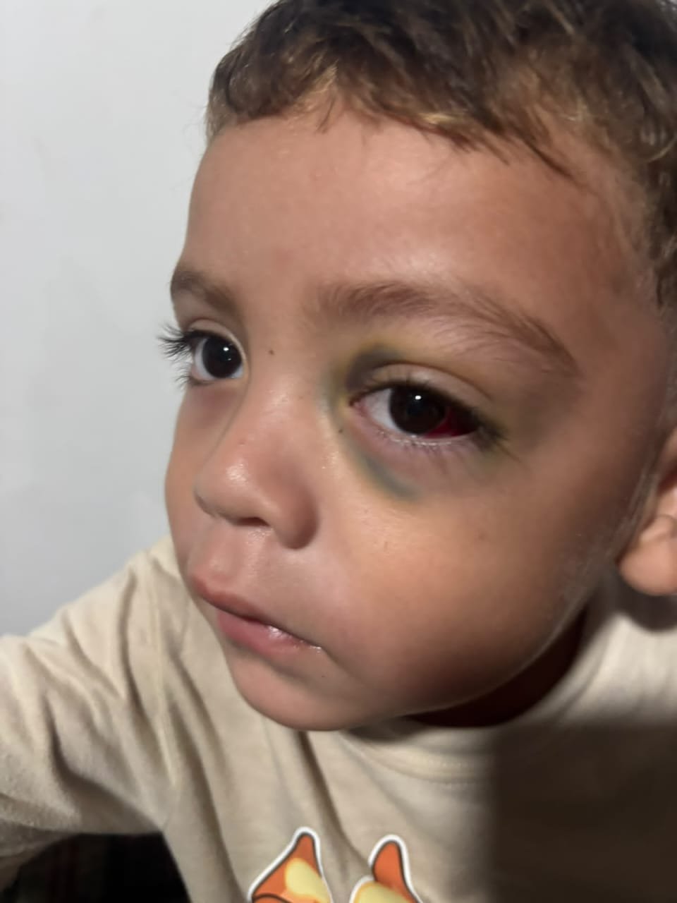 Hope for Liam’s Tests, surgery & Care in Mérida campaign photo, 2 of 7
