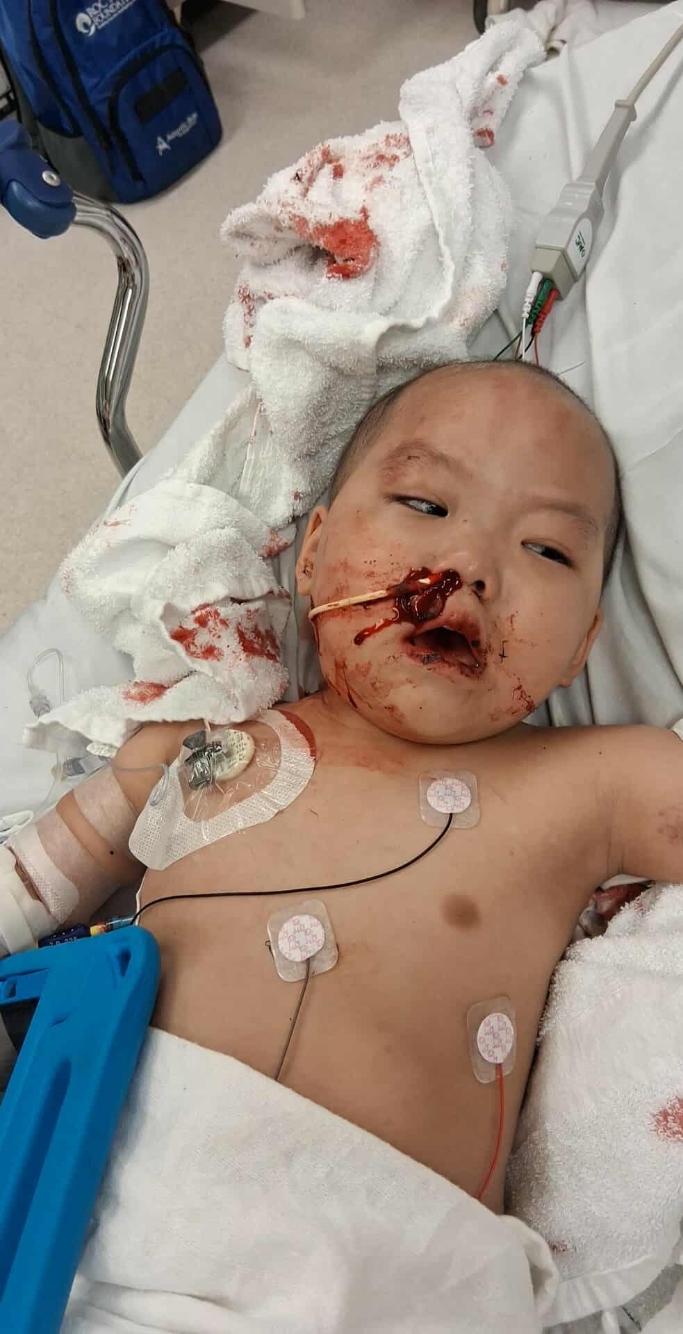 3 years Alina Xiong loses battle with cancer campaign photo, 5 of 8