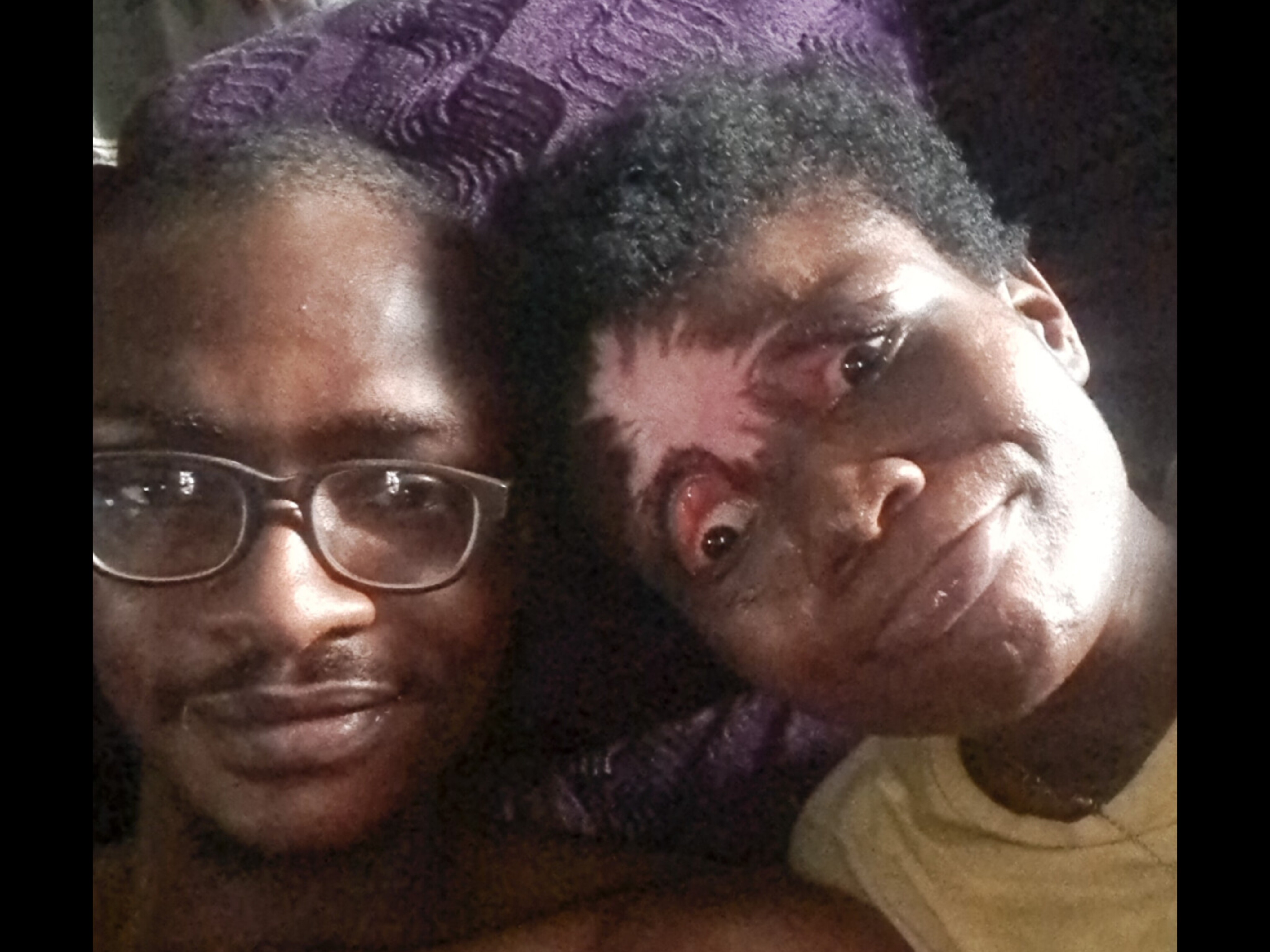 Hope for Mary , Epilepsy Care & Critical Surgeries campaign photo, 2 of 5