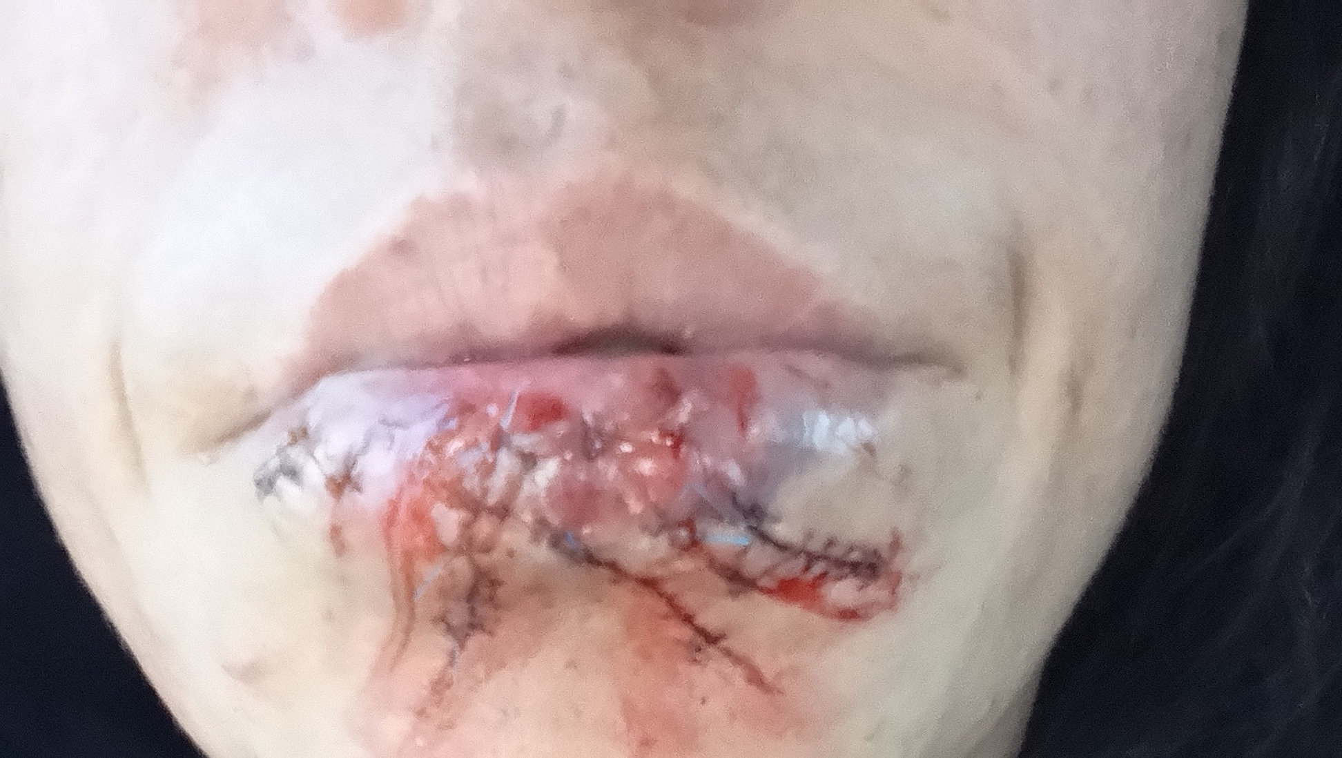 Support Claire's Recovery from Surgery photo