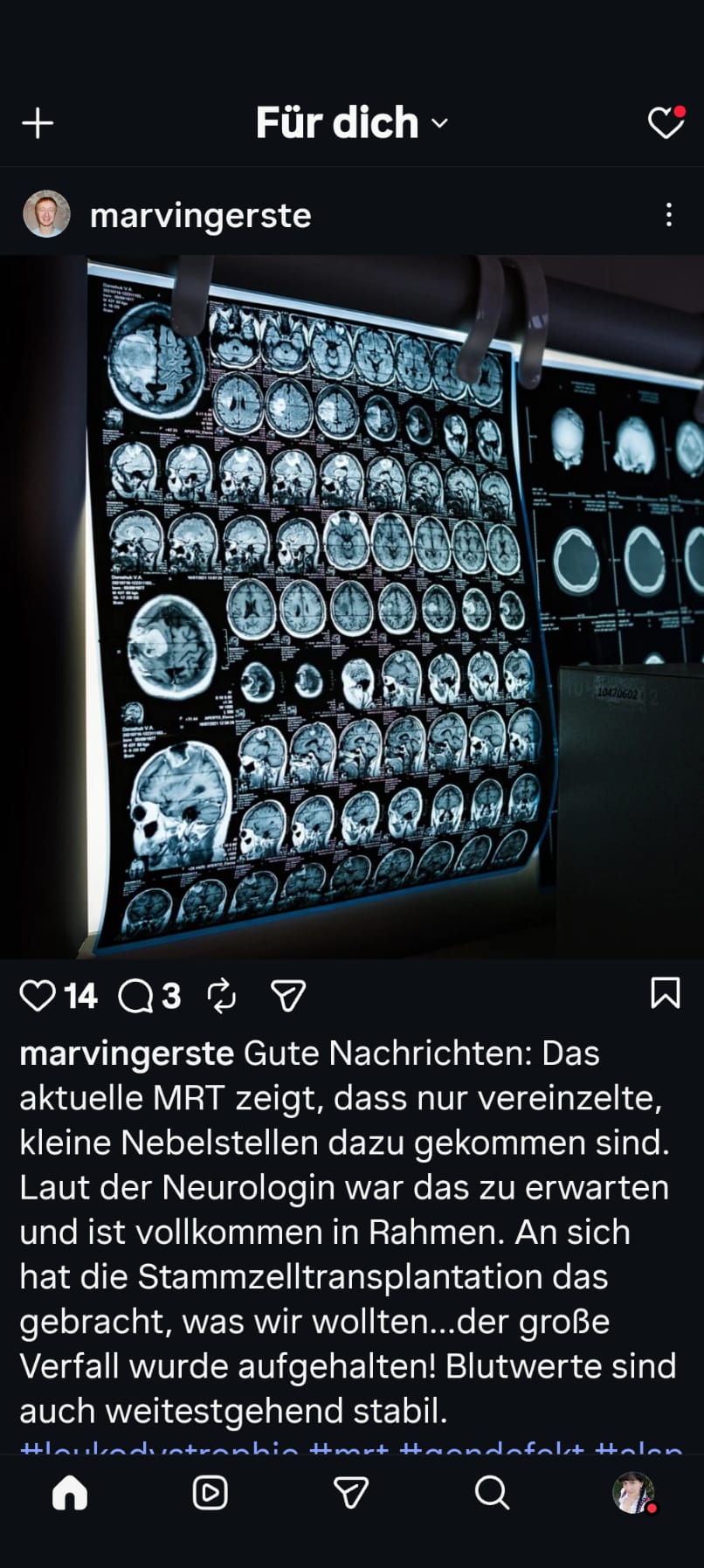Kampagnen-Foto für Leukodystrophie, eine sehr seltene Erkrankung,nicht heilbar, 2 von 6