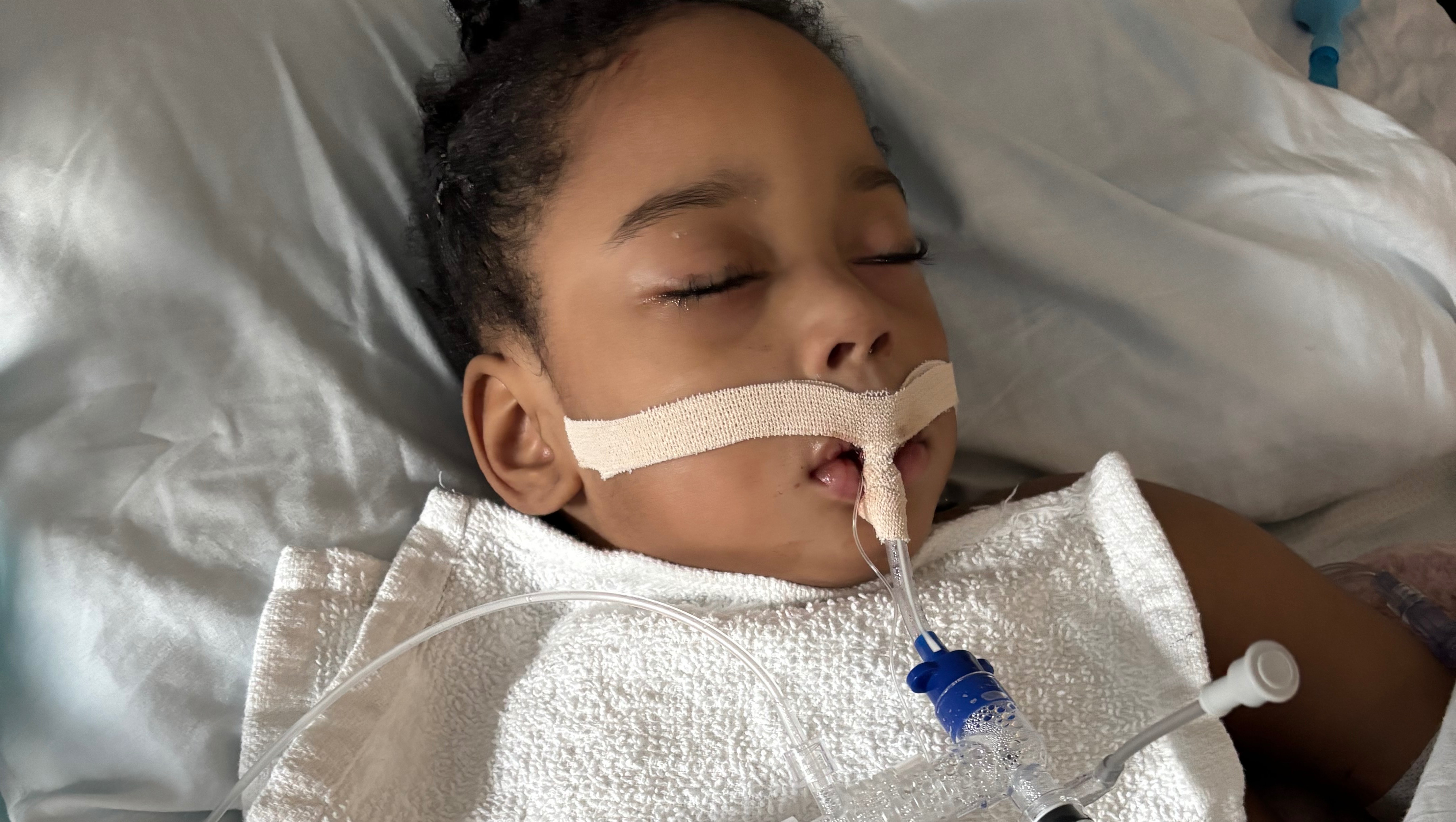 Fighting for Every Breath: ICU Battle on a Ventilator photo
