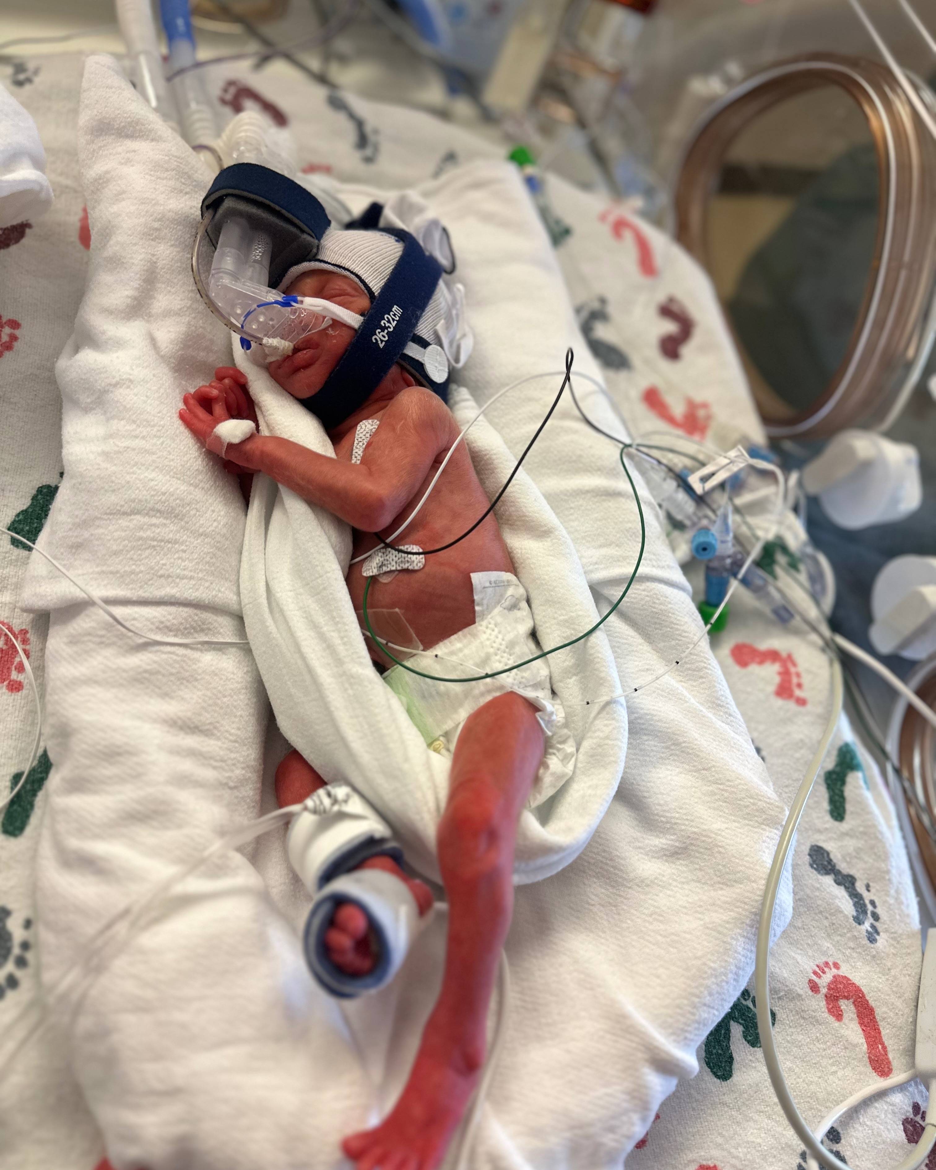 Fundraiser for morgandy hobert by Lindsay Hobert : Care for ...