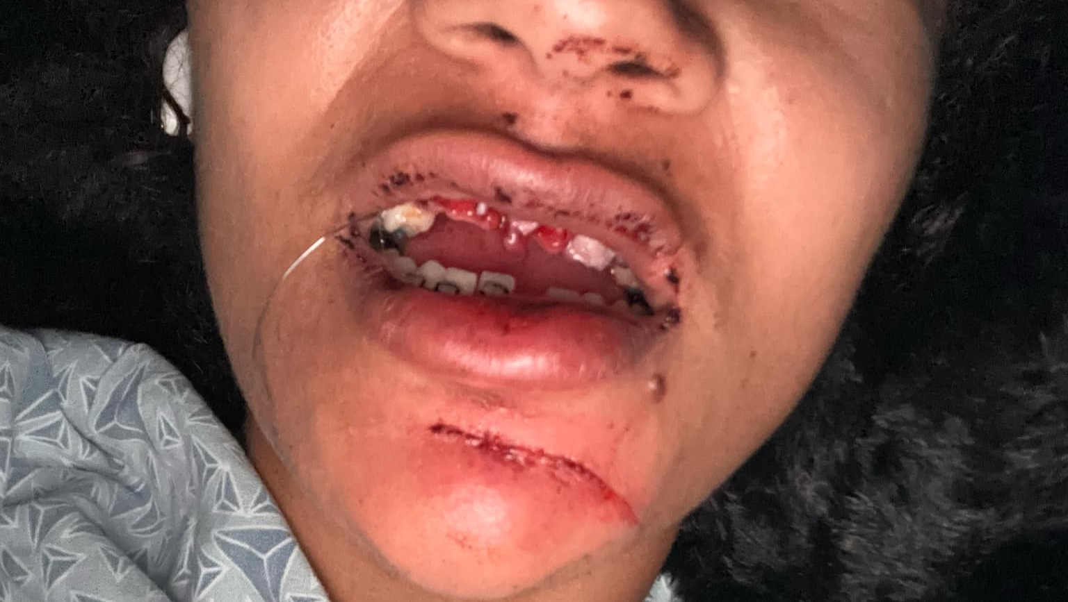 Support nikita's lil sister move forward after a tragedy pinned link photo