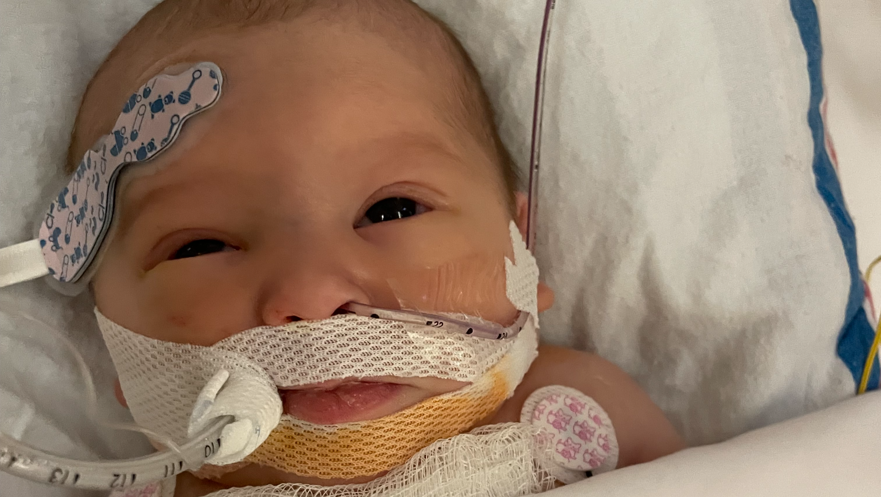 Support Baby Elliana’s Recovery after Open Heart Surgery photo