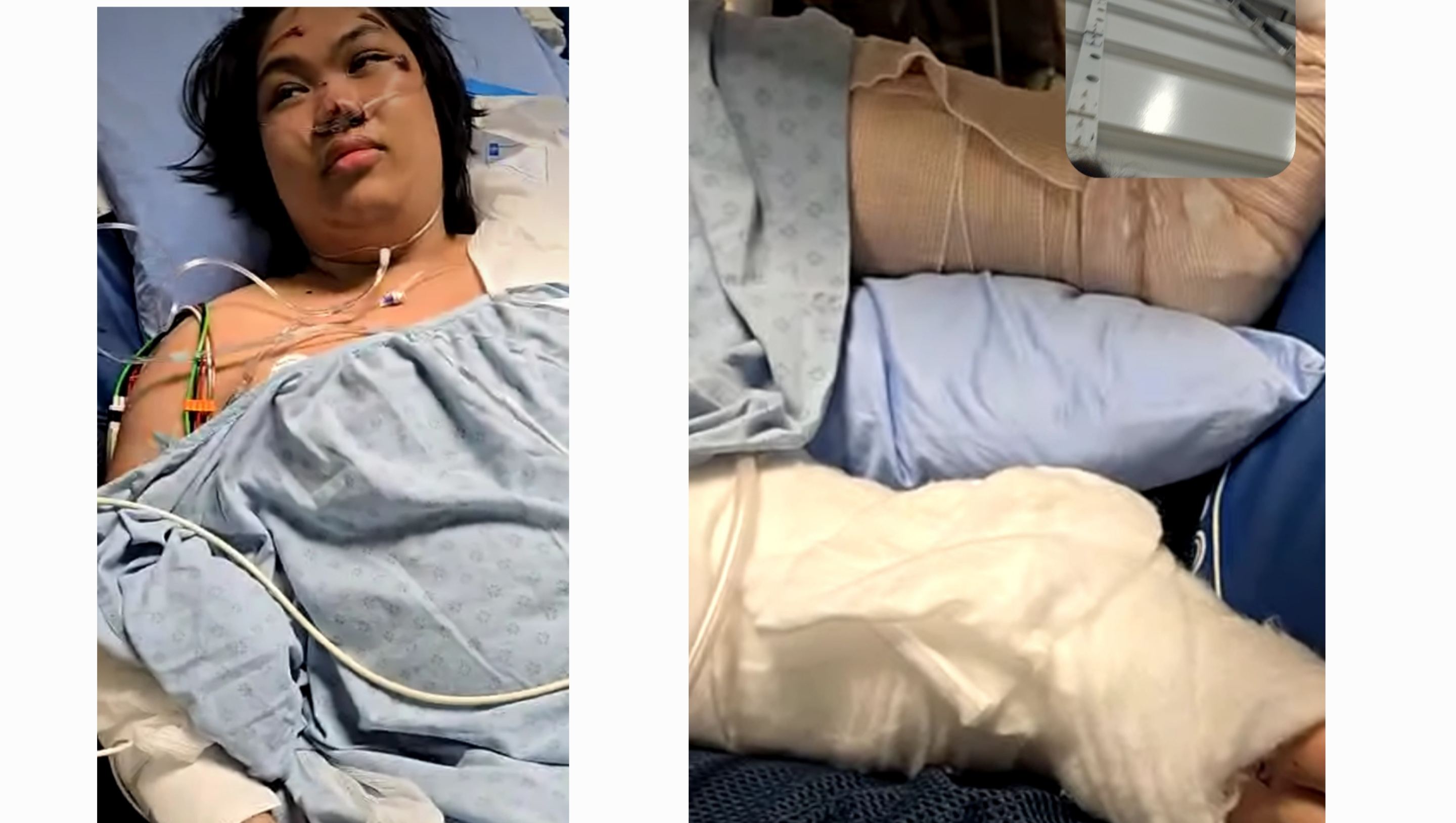 Support for ZOE TIMOGTIMOG after Lapu lapu tragedy pinned link photo