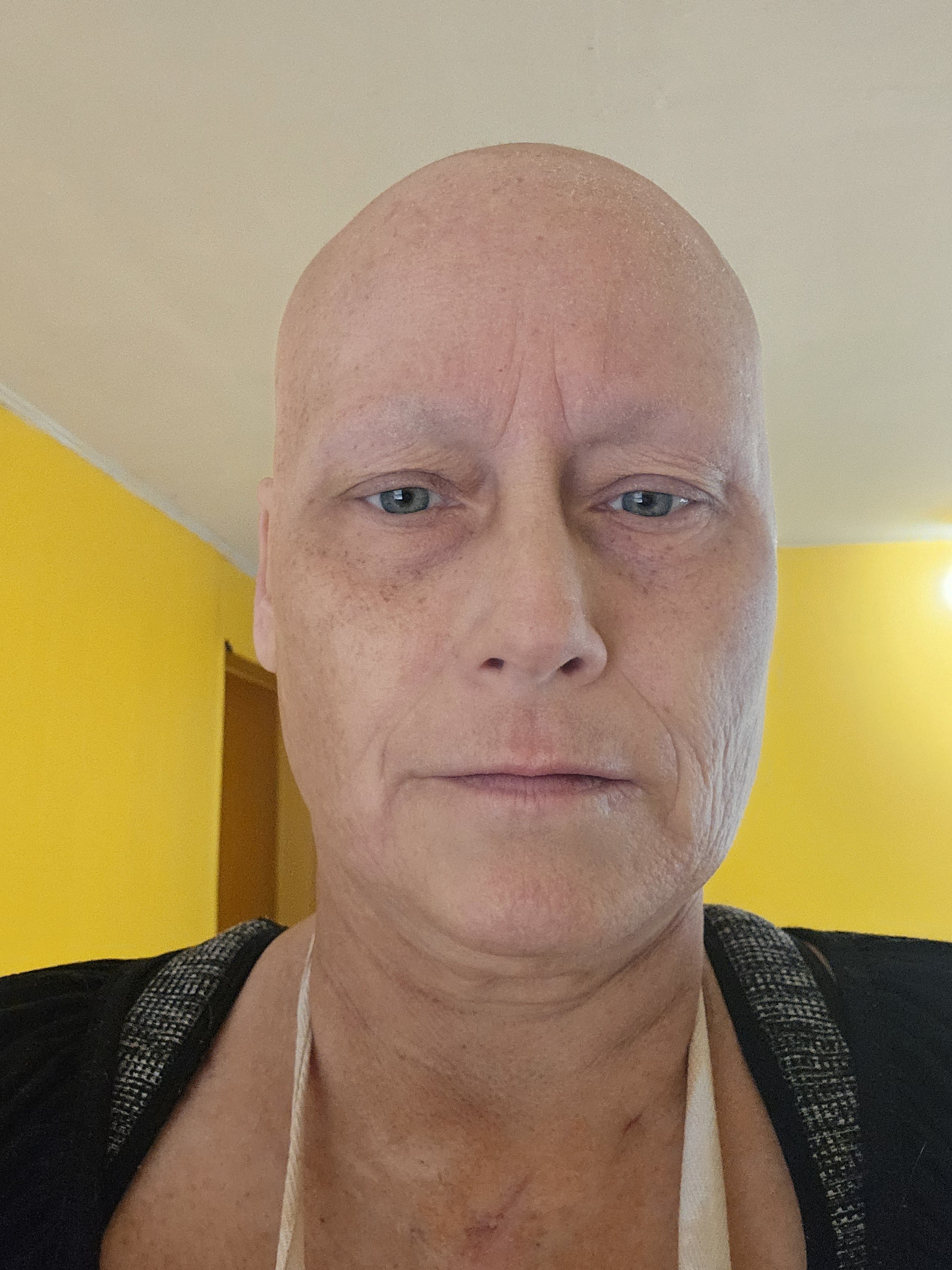 Urgent: Pam’s Cancer Treatment campaign photo, 6 of 8