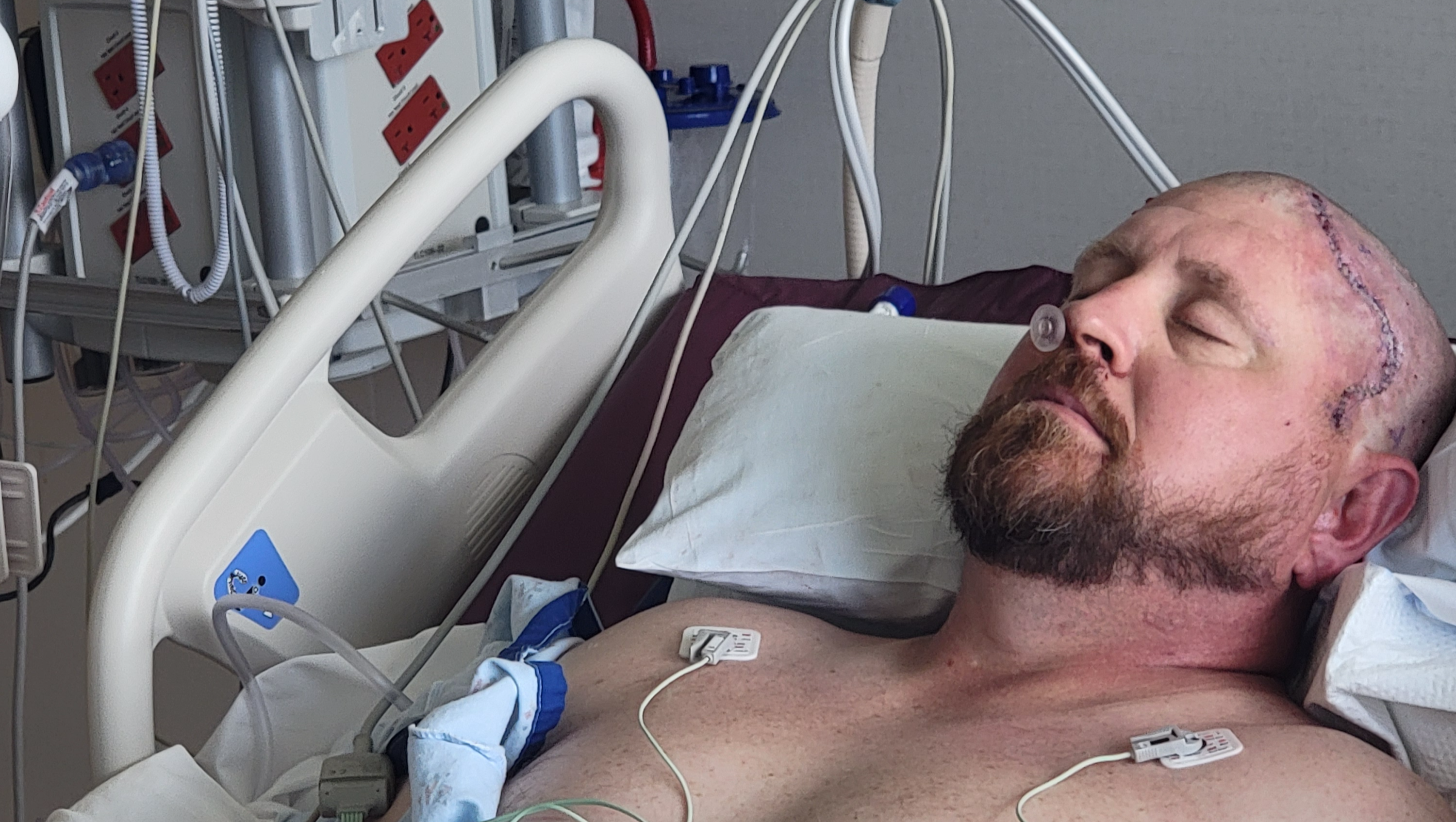 Fundraiser for Samuel Dosch by Ben Dosch : Donate to Aid Sam's