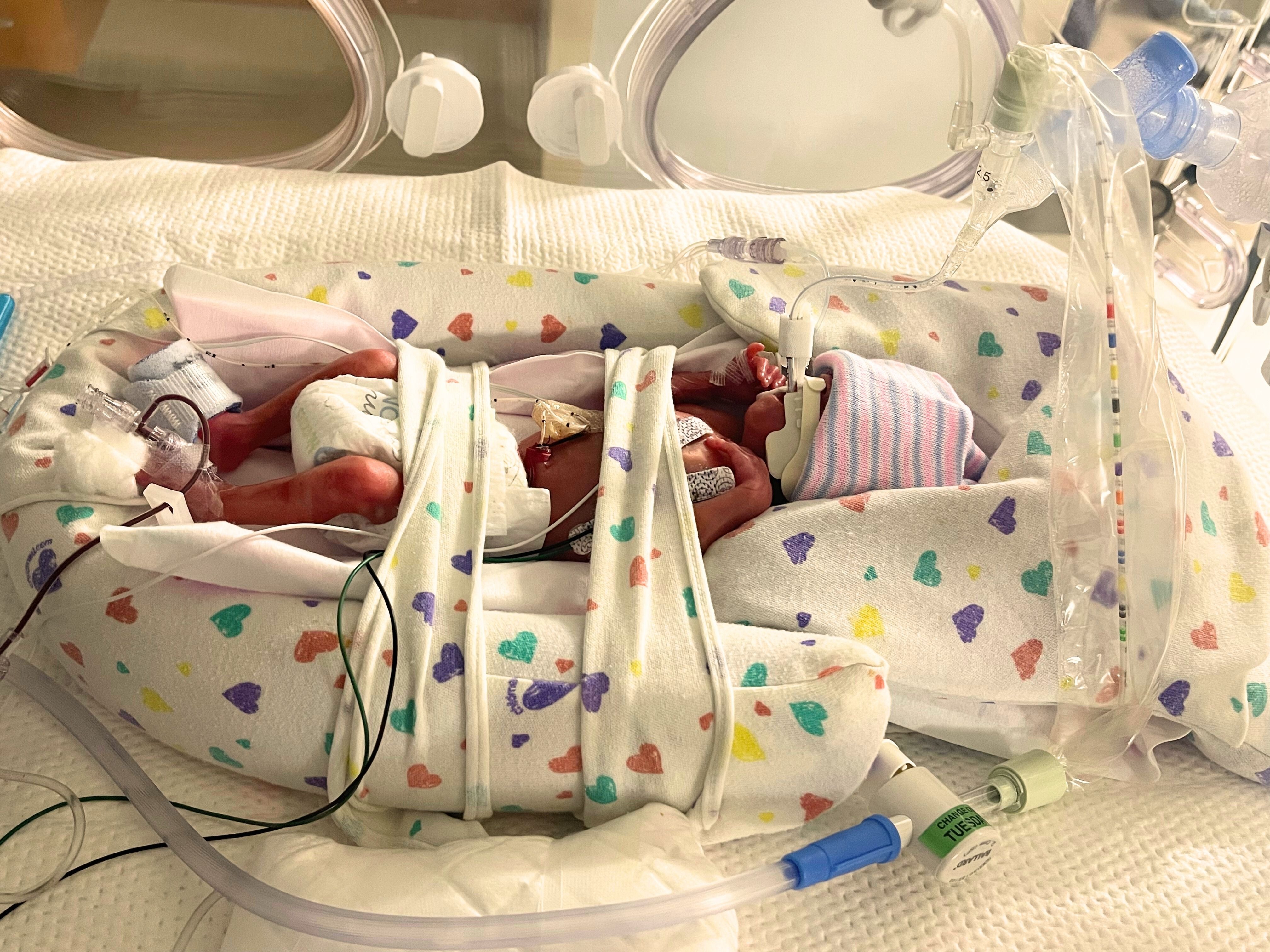 Support Eliana's Fight for Life in the NICU campaign photo, 2 of 6