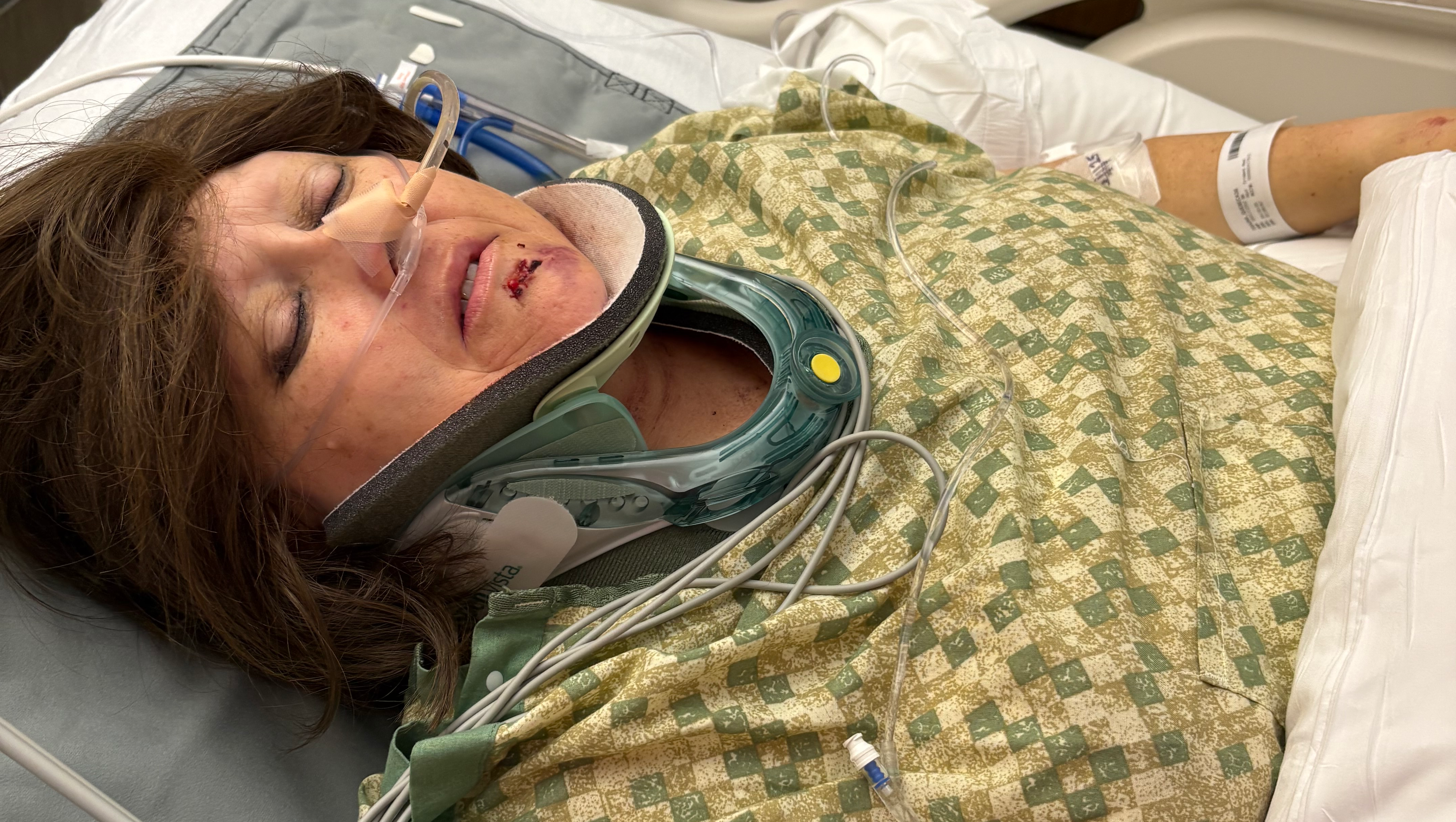 “Life Changed in an Instant-Allisons Recovery Fund” photo