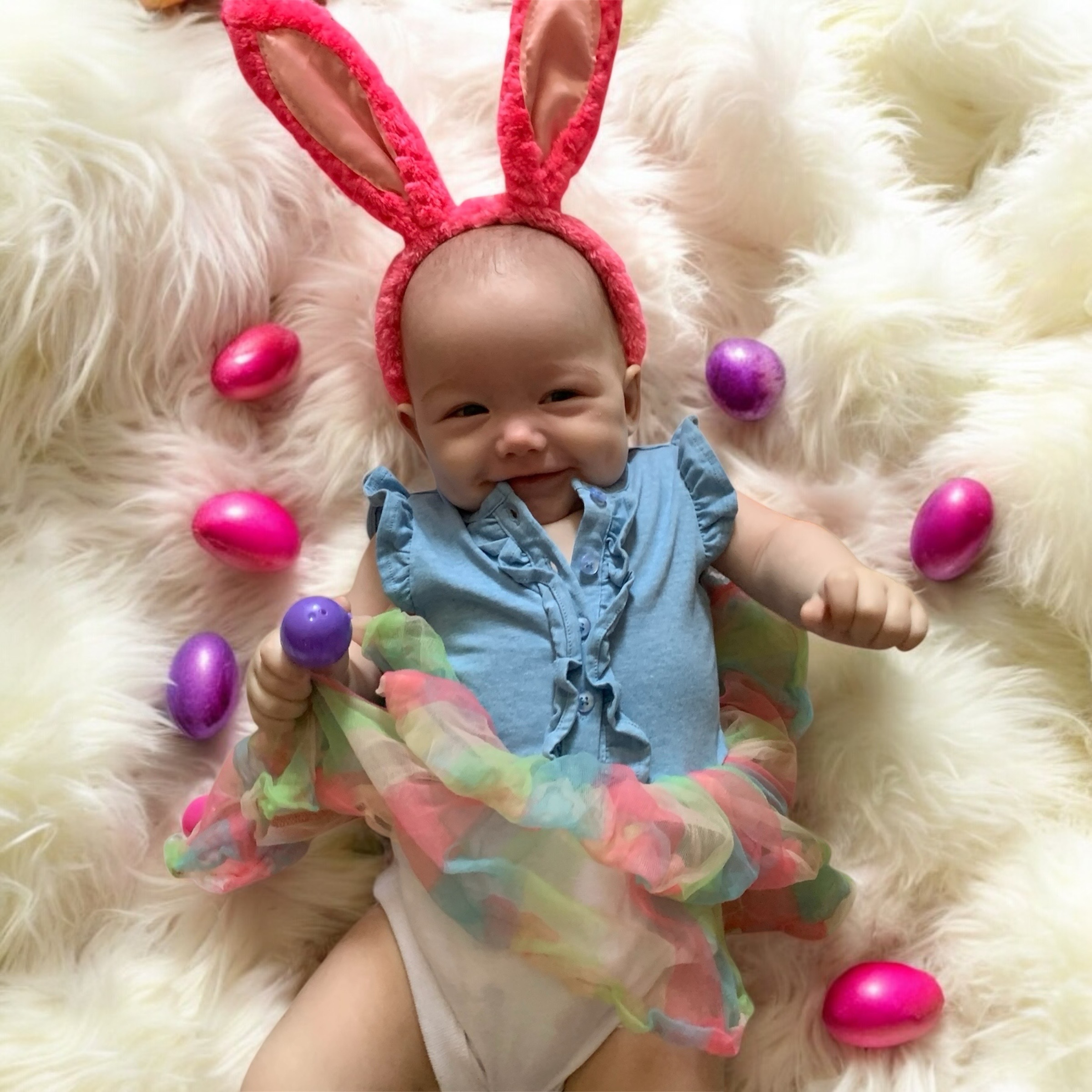 Sweet Isla needs treatment for Scaphocephaly campaign photo, 2 of 8