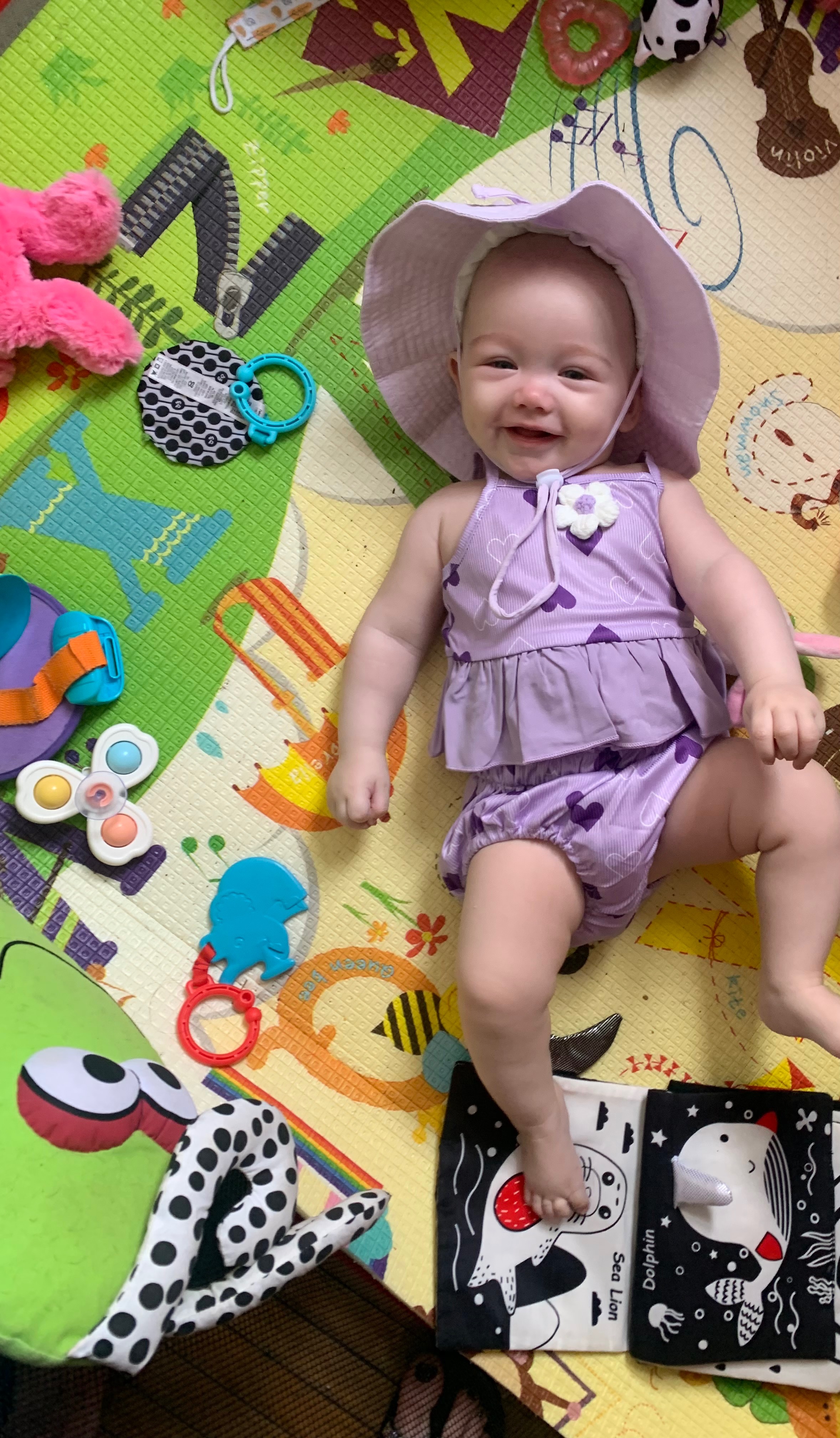 Sweet Isla needs treatment for Scaphocephaly campaign photo, 4 of 8