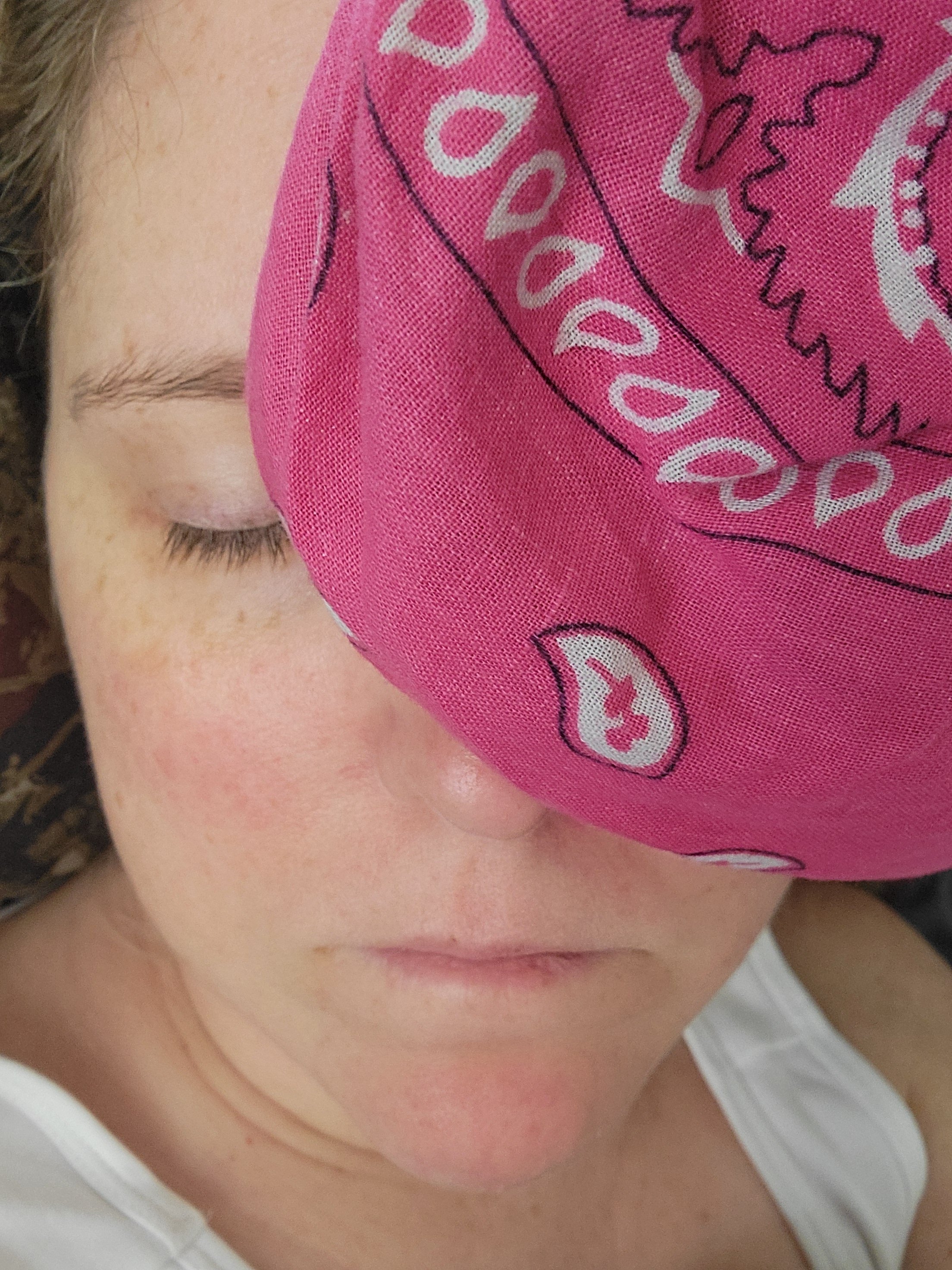 Life Changing Nerve Surgery - One Year Update campaign photo, 2 of 7