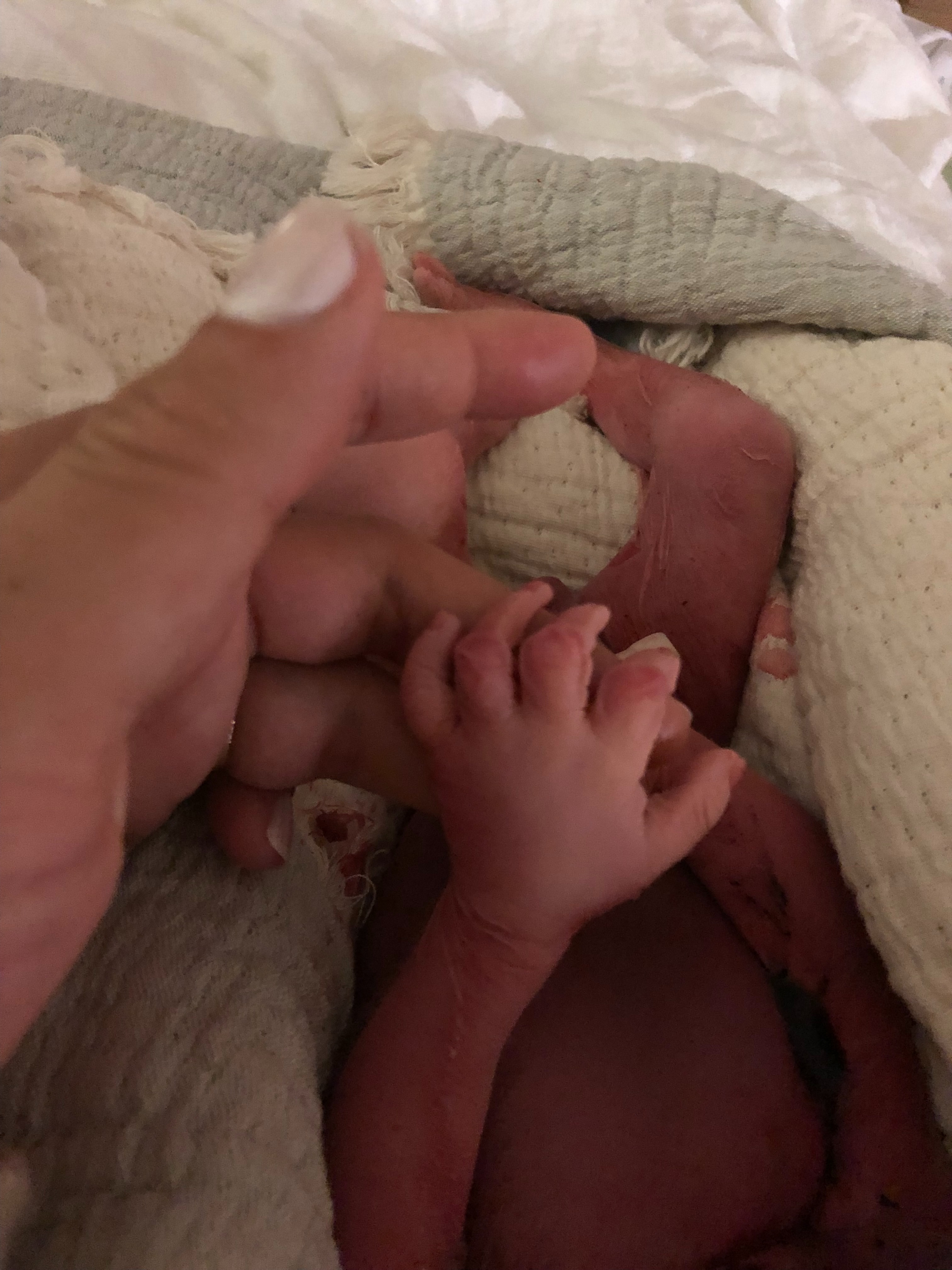 Baby Joshua's Fight & Family in Need campaign photo, 2 of 5