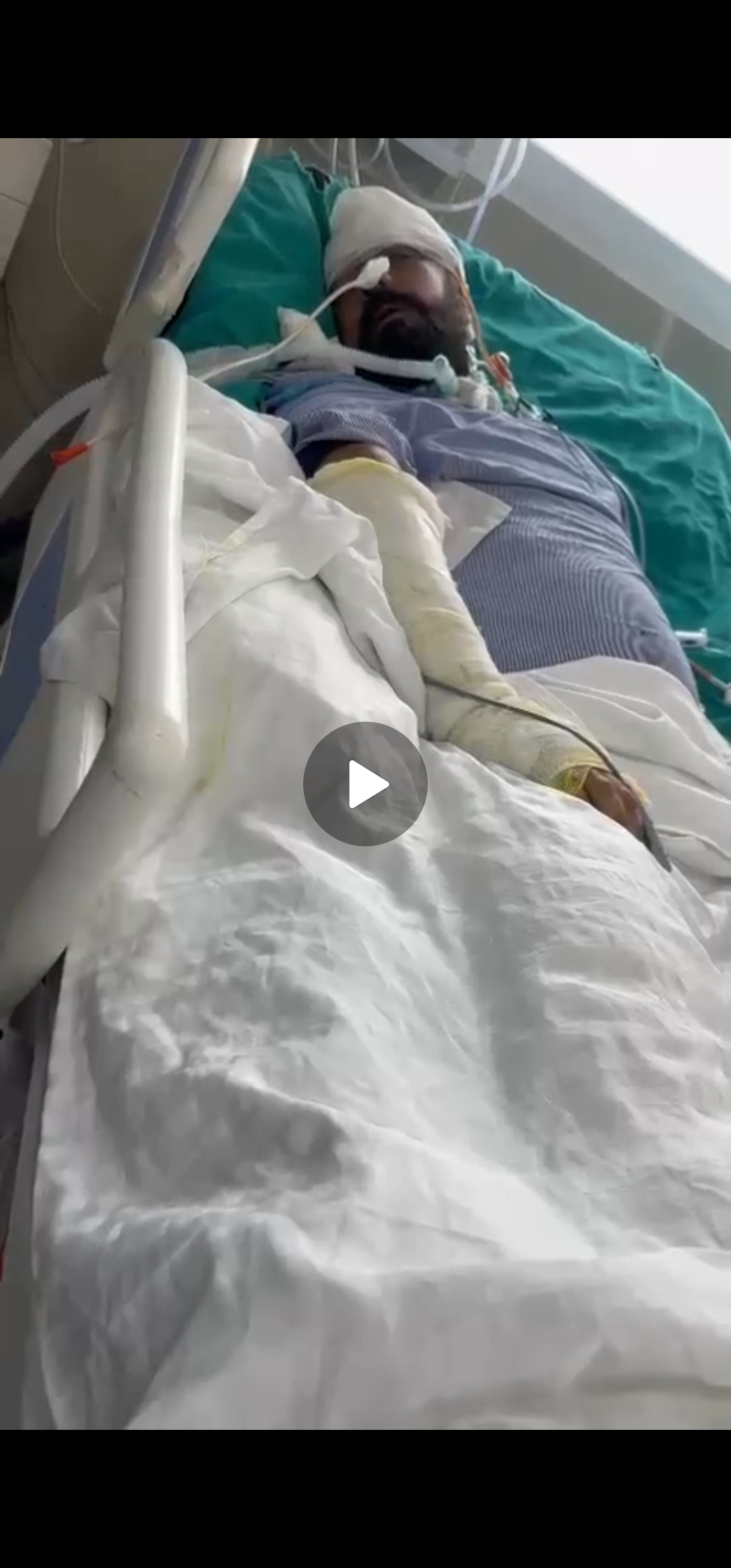 ICU Costs After a Brutal Axe Attack - Seeking Support & help campaign photo, 2 of 4