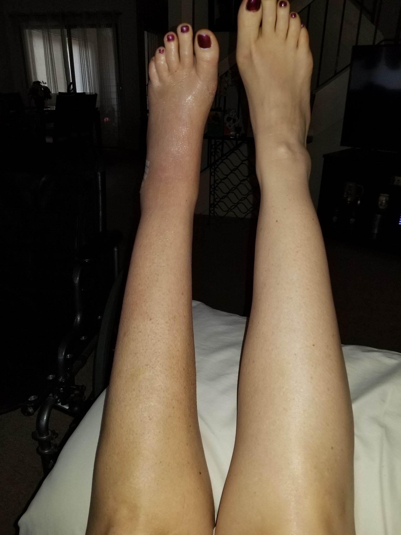Help My Mom Get the Procedures She Desperately Needs campaign photo, 5 of 6
