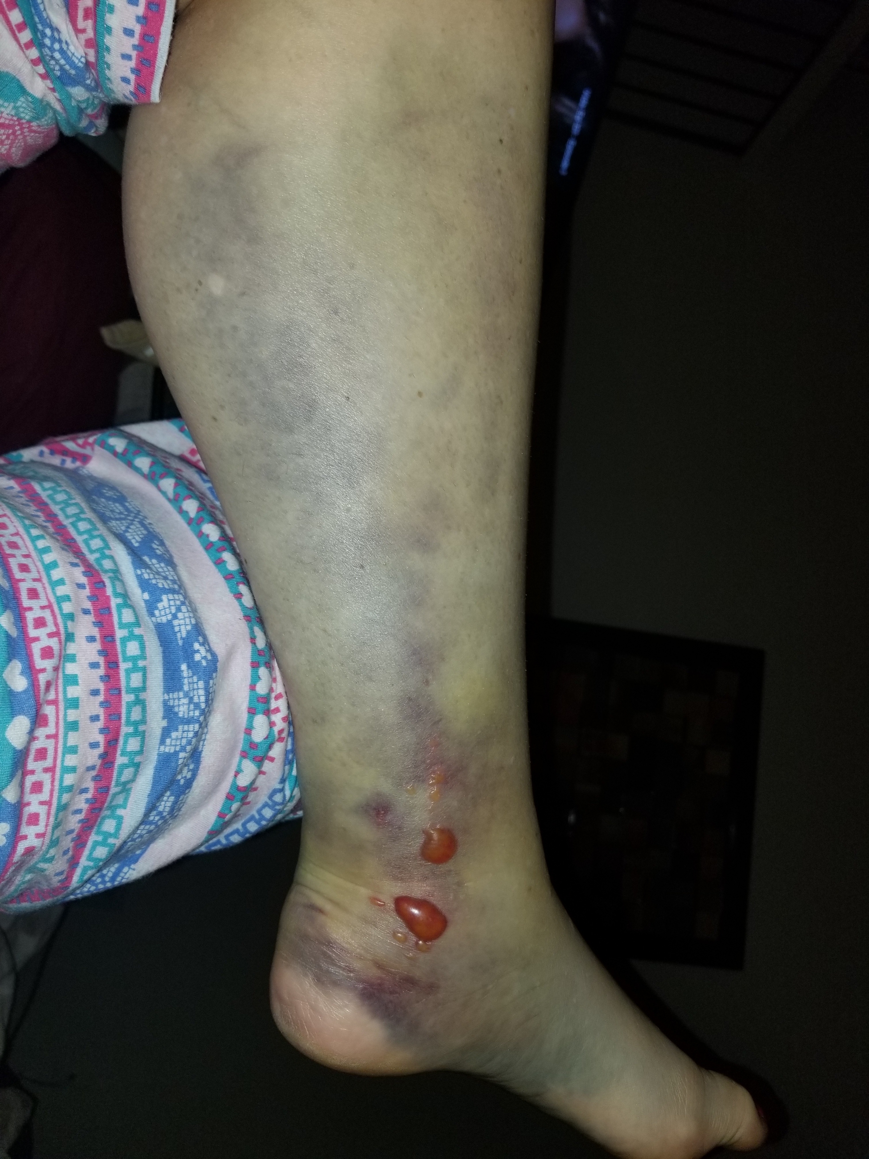 Help My Mom Get the Procedures She Desperately Needs campaign photo, 2 of 6