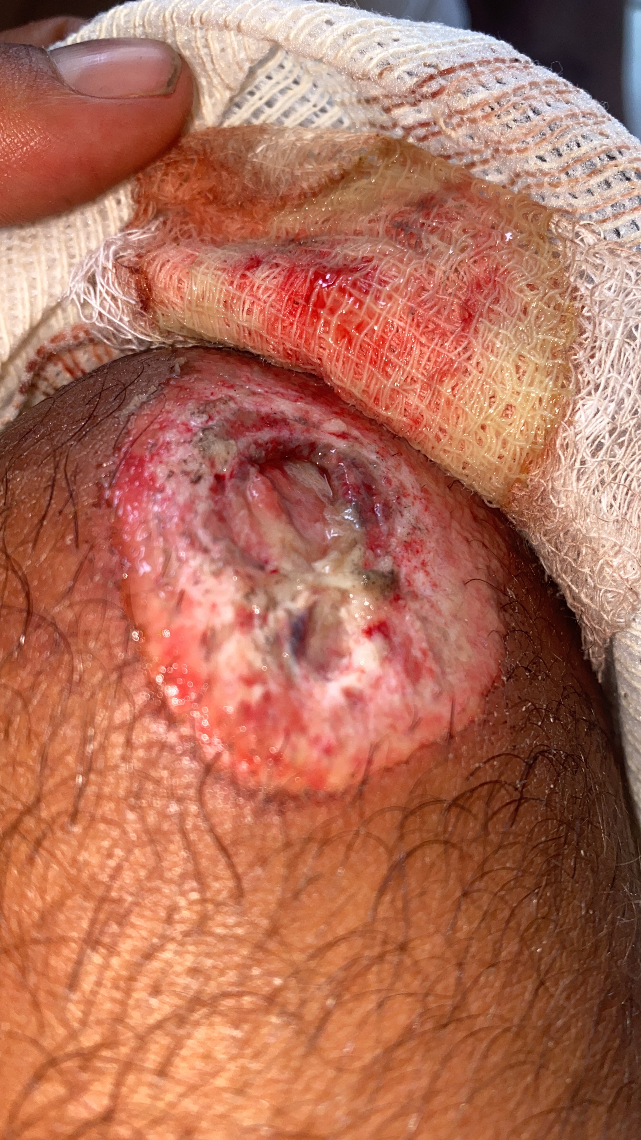 Recuperar la movilidad en mi rodilla campaign photo, 7 of 8