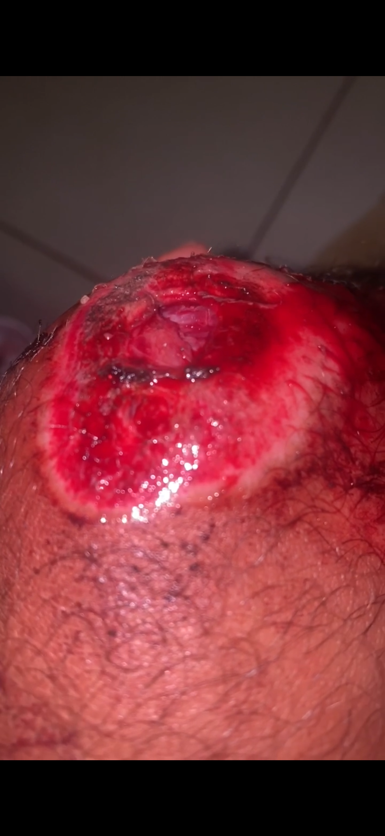 Recuperar la movilidad en mi rodilla campaign photo, 2 of 8