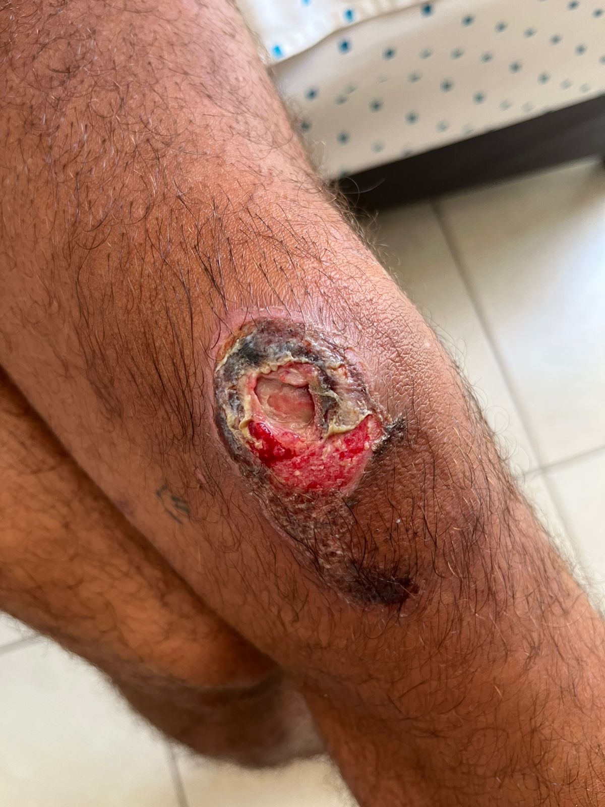 Recuperar la movilidad en mi rodilla campaign photo, 4 of 8