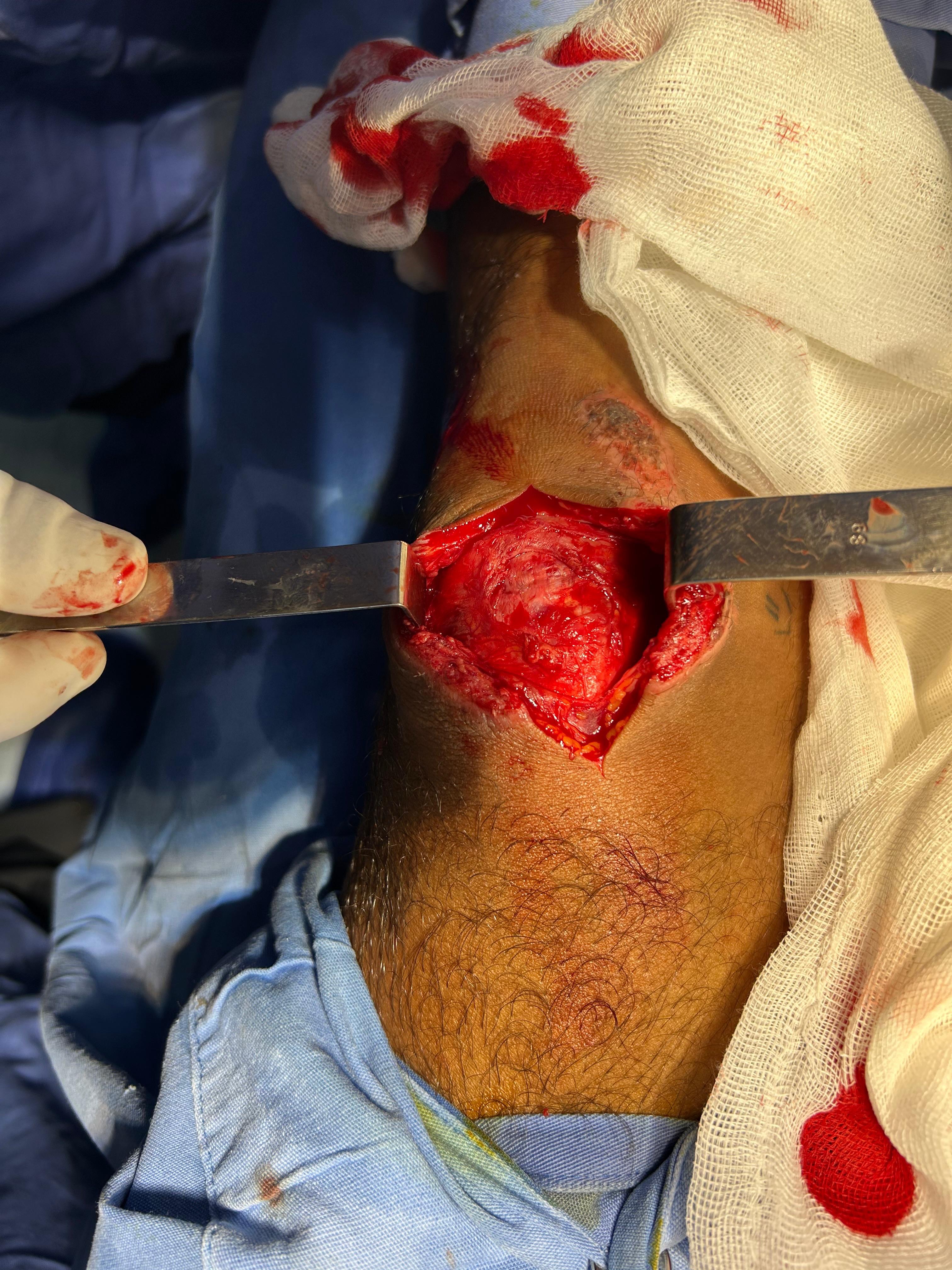 Recuperar la movilidad en mi rodilla campaign photo, 5 of 8