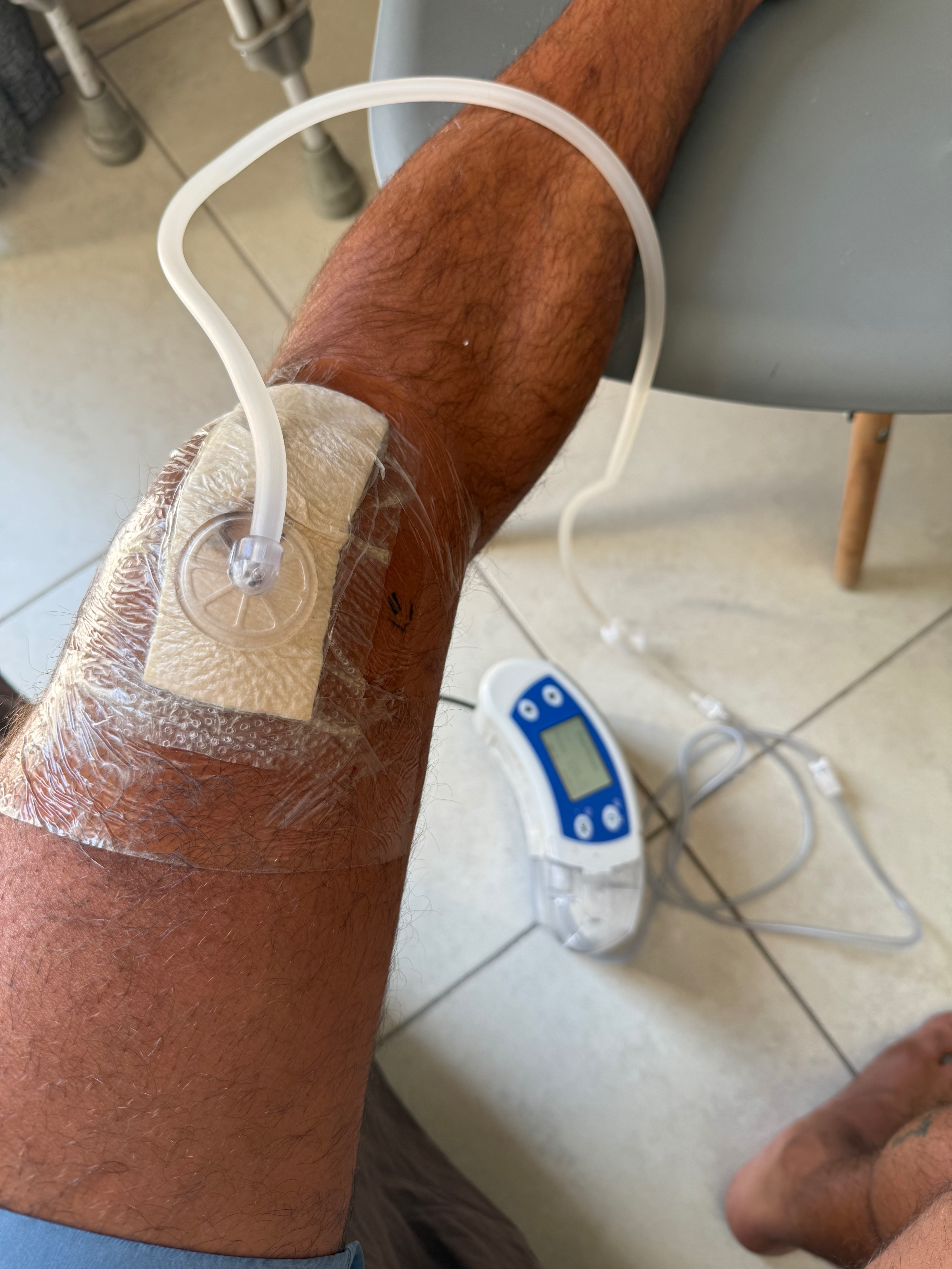 Recuperar la movilidad en mi rodilla campaign photo, 6 of 8