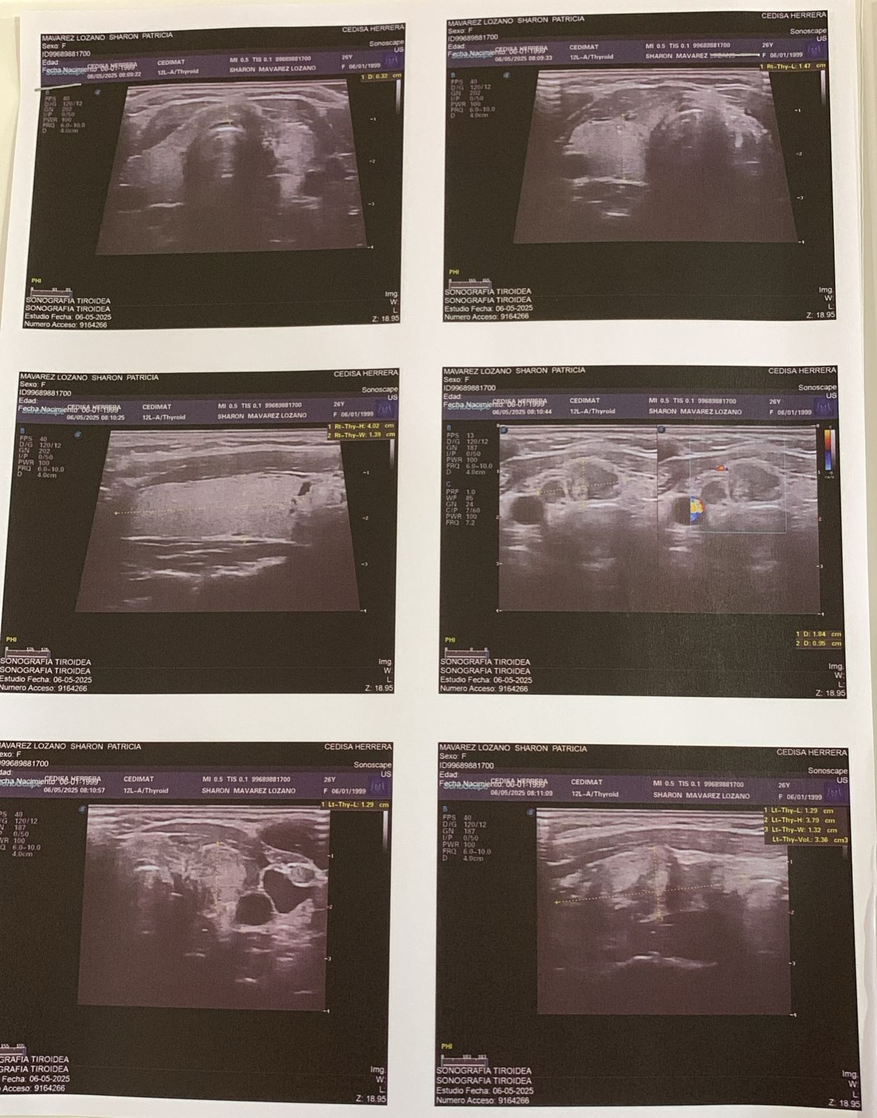 Help Us Fight Sharon’s Thyroid Cancer: Surgery and Treatment campaign photo, 2 of 7