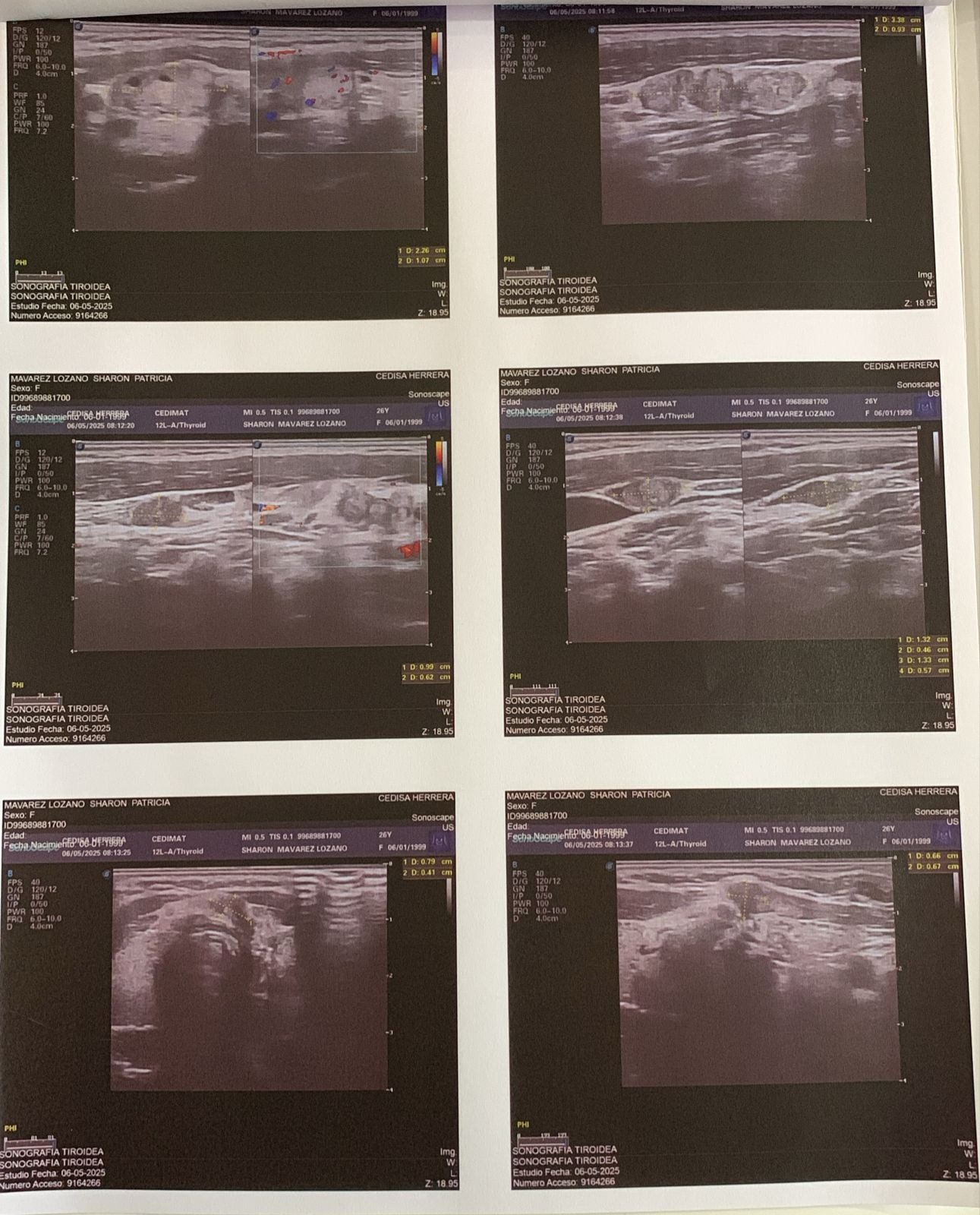 Help Us Fight Sharon’s Thyroid Cancer: Surgery and Treatment campaign photo, 4 of 7