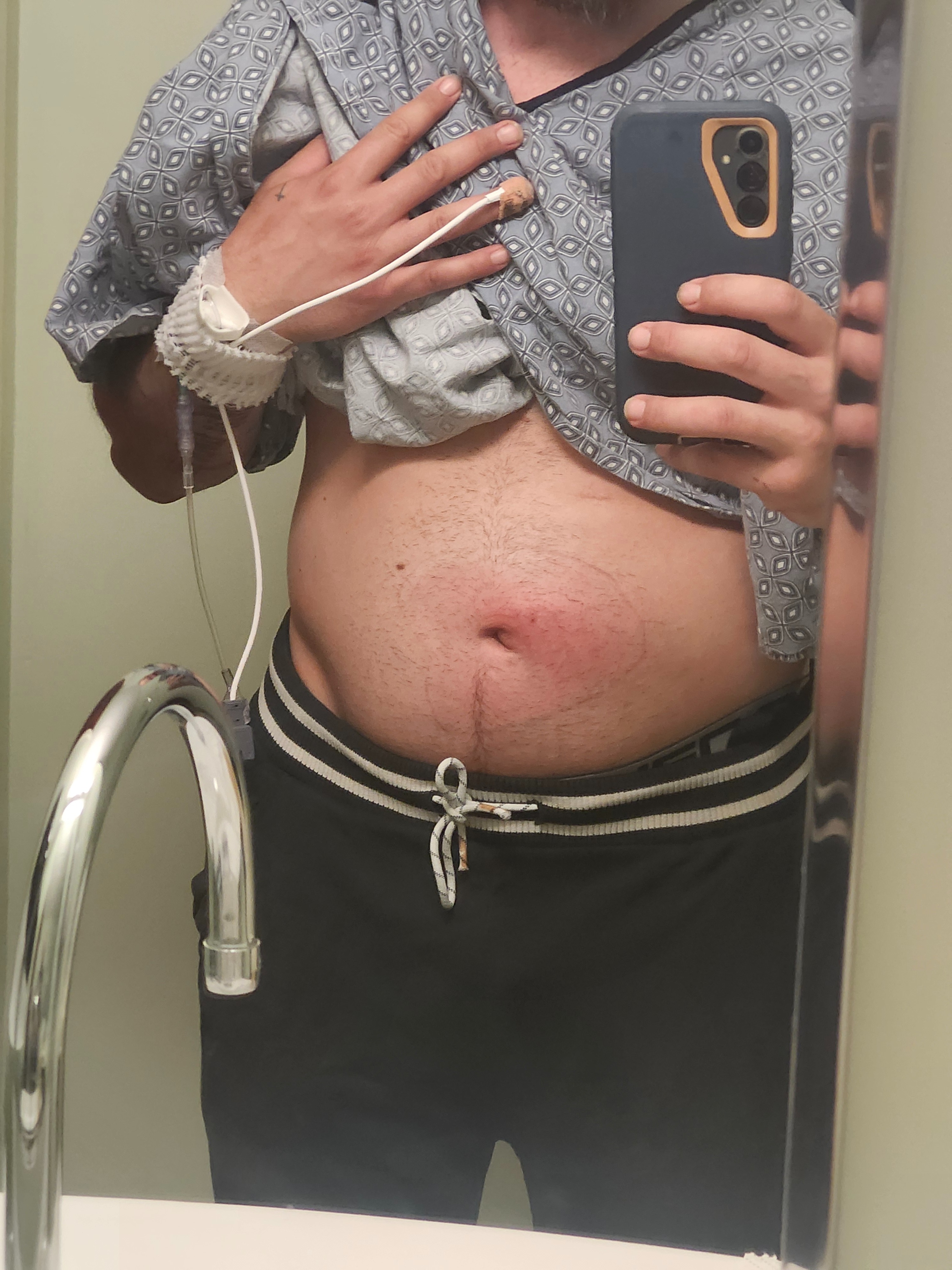 Help Me Avoid Eviction And Utility Shut Off After Surgery campaign photo, 2 of 8
