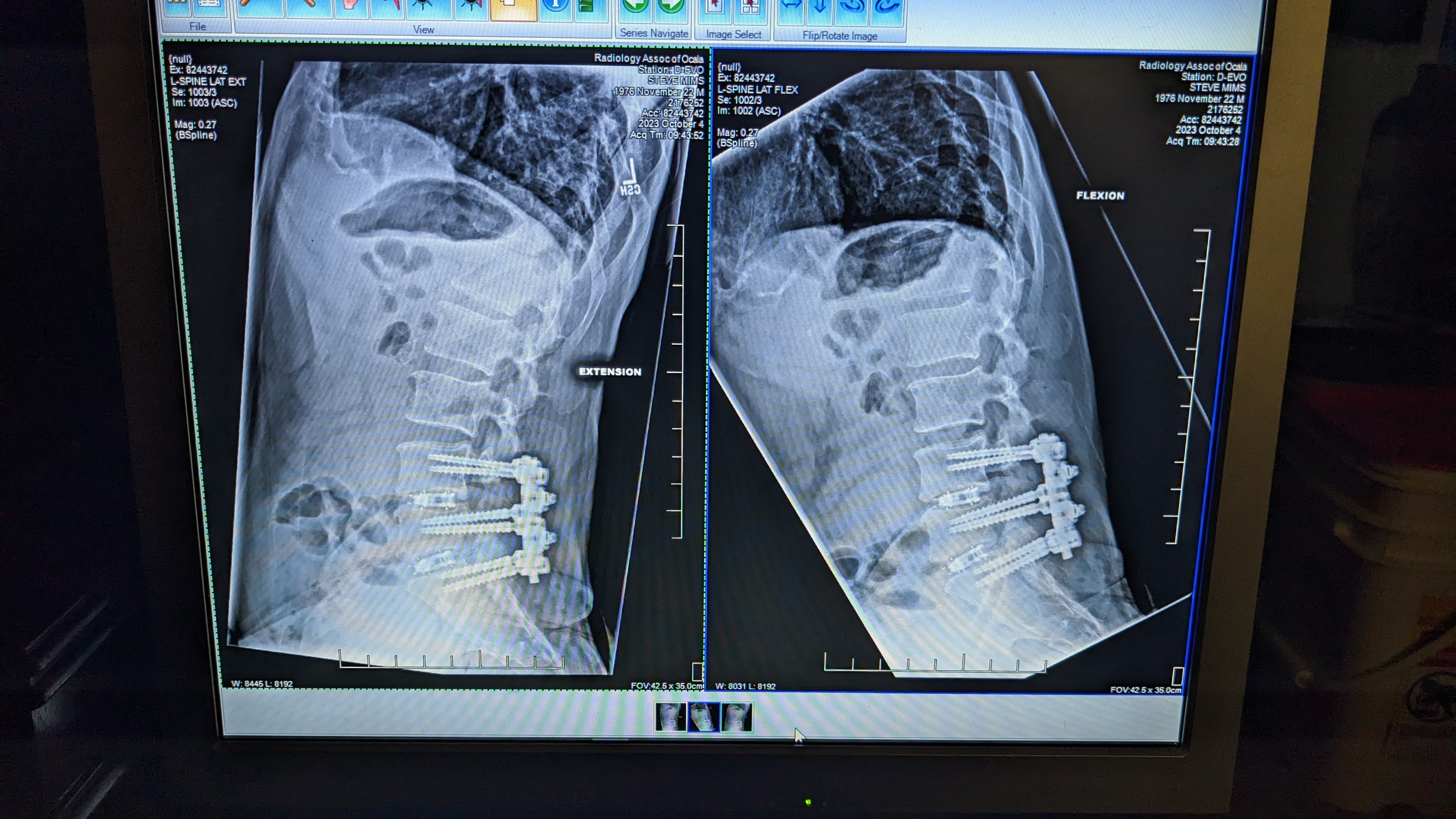 Steve's Back Injury Recovery Fund campaign photo, 2 of 4