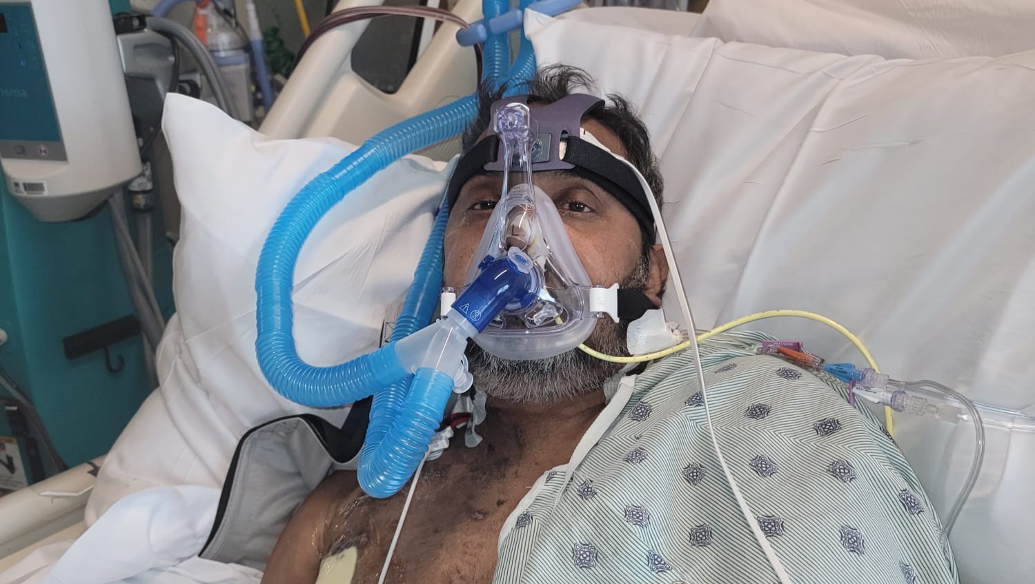 Support Shashank's Heart & Kidney Transplants photo