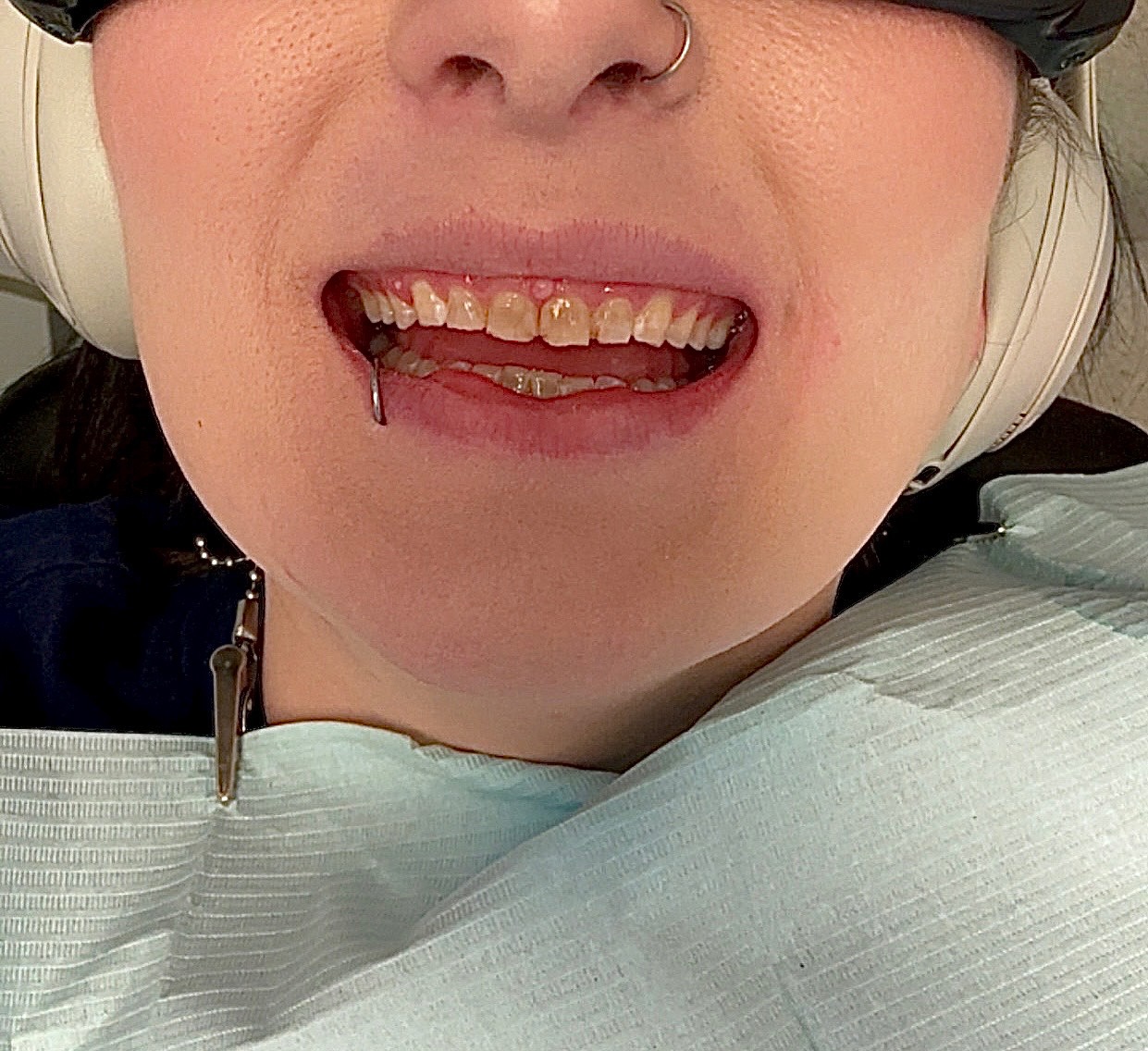 Please Help Support Riley’s Urgent Dental Needs campaign photo, 2 of 4