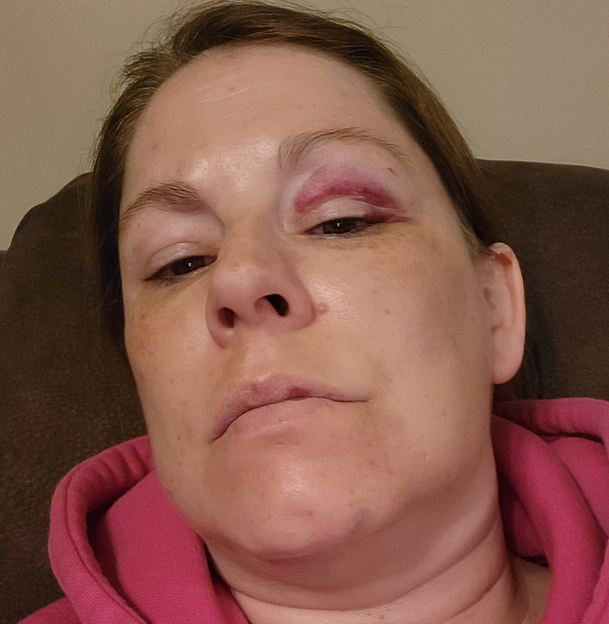 Help a Resilient Family Overcome Medical Hardships campaign photo, 2 of 8