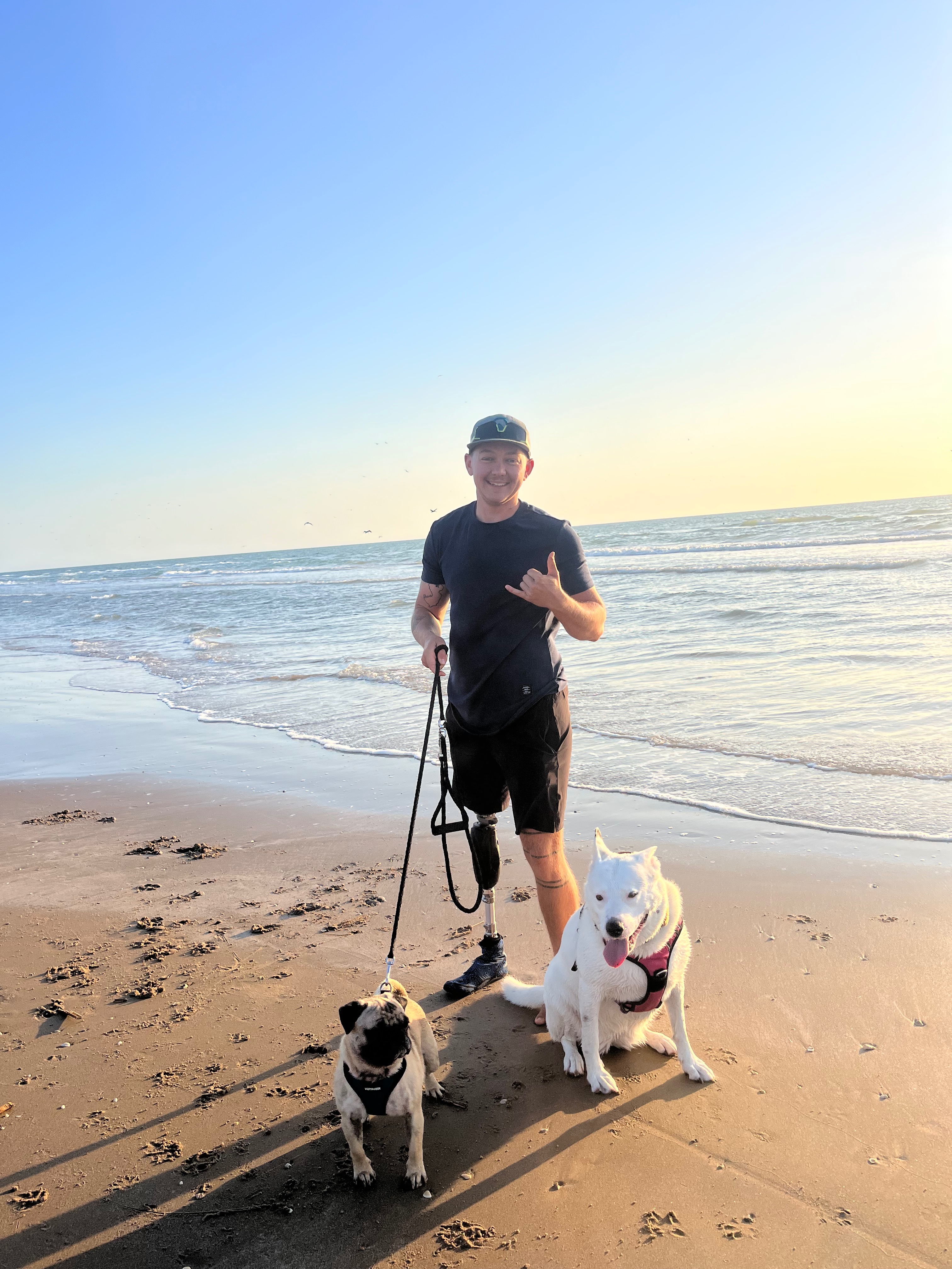 Amputee Trekking 5,000 Miles Unbroken to Help Others campaign photo, 2 of 8