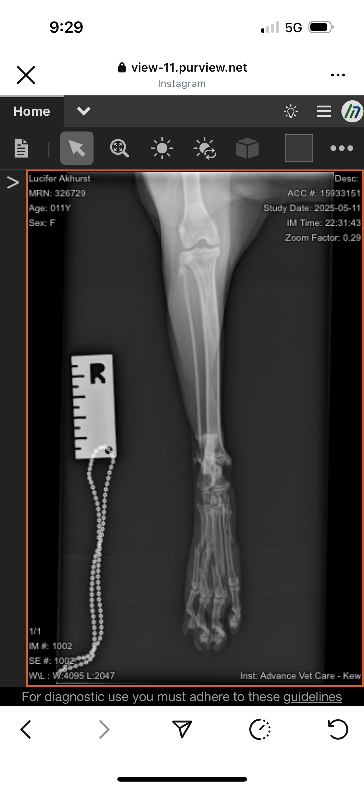 Surgery fund for Miss Mao campaign photo, 5 of 7