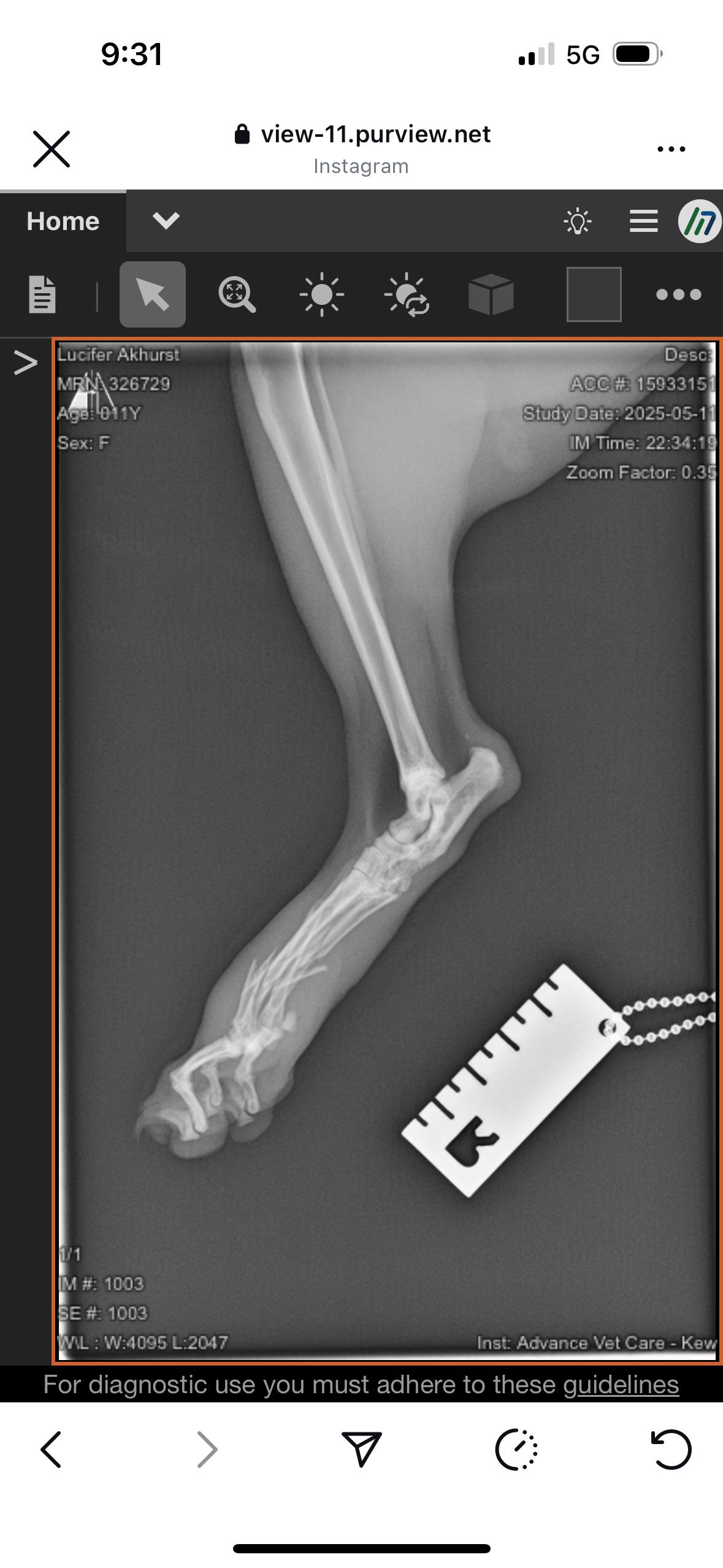 Surgery fund for Miss Mao campaign photo, 6 of 7