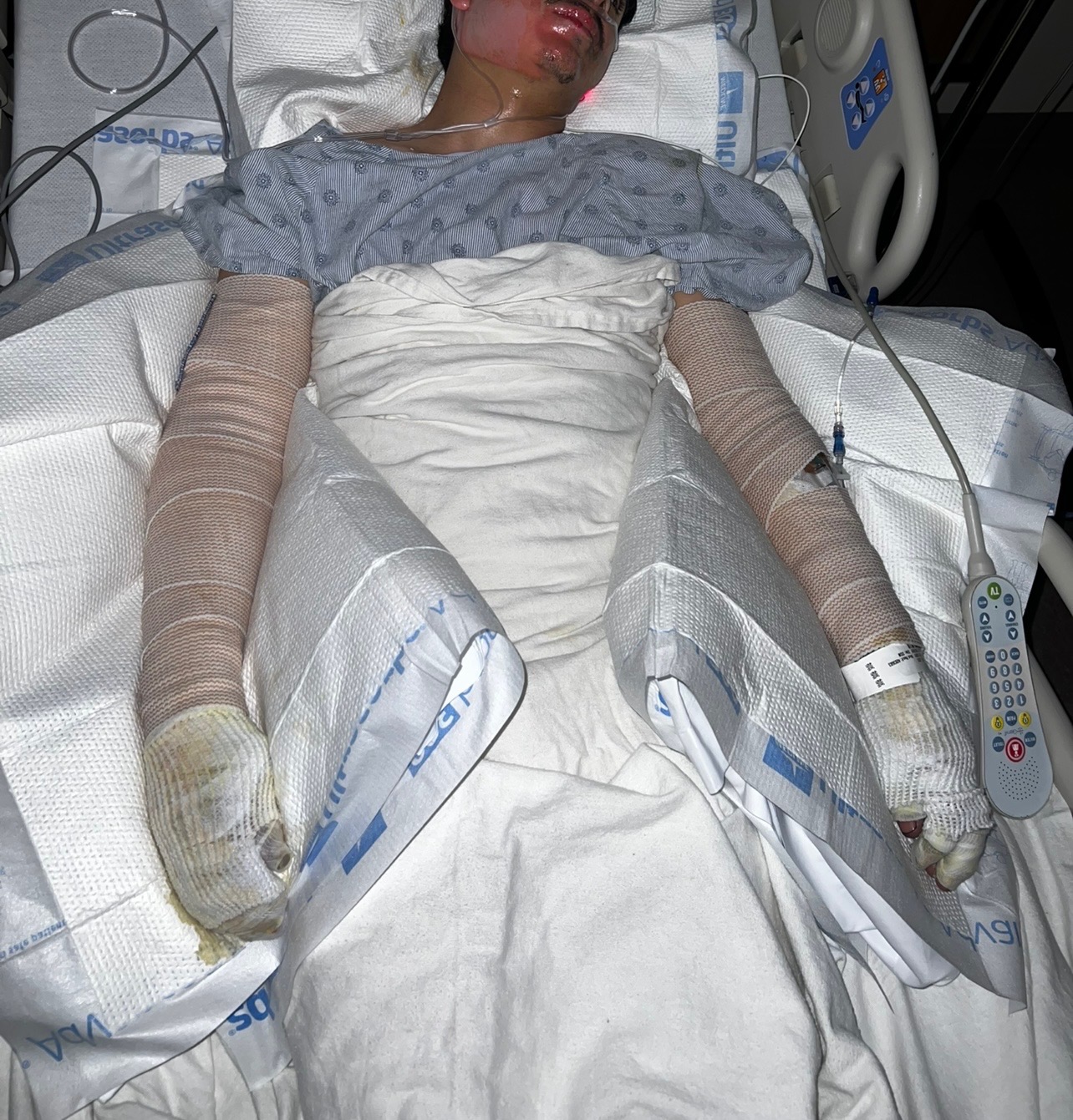 Apoyo urgente para la recuperación de mi hermano… campaign photo, 2 of 4