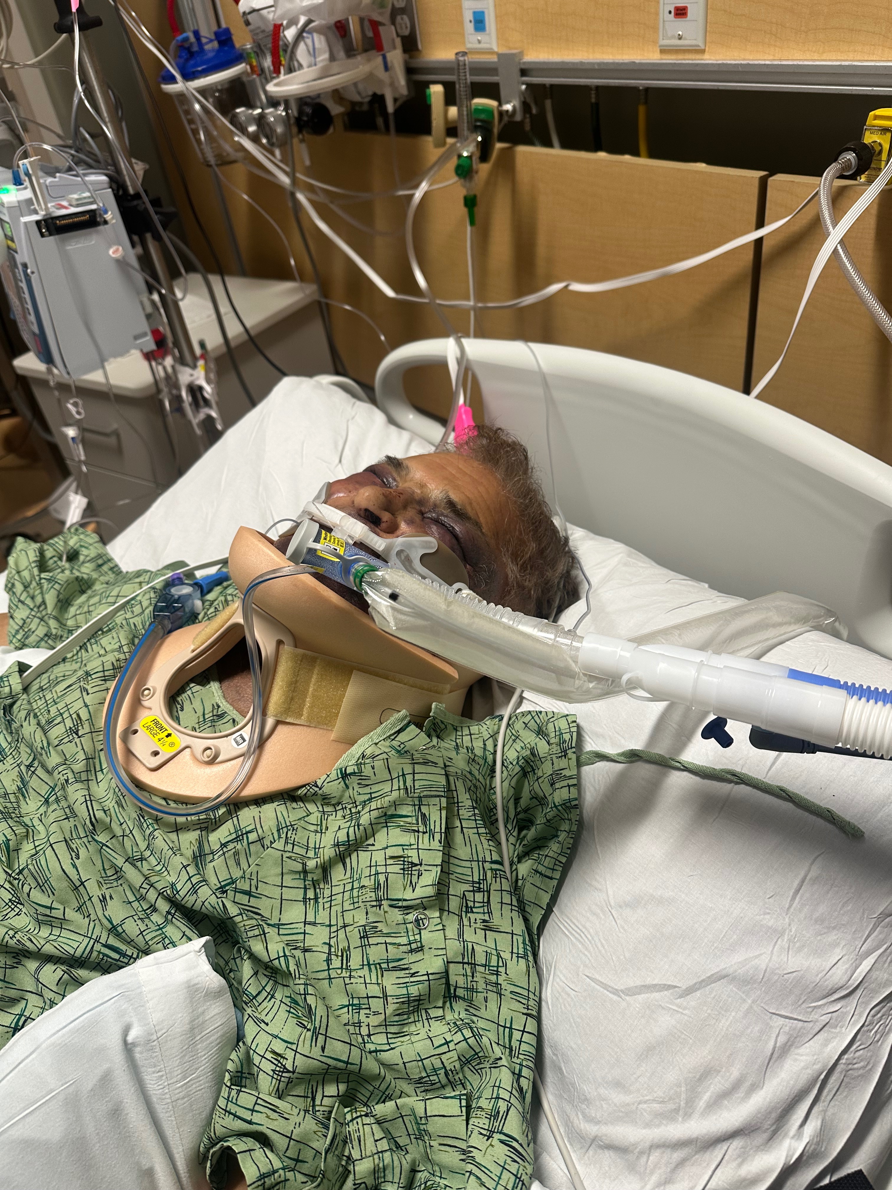 Support Jim Oliver's Recovery After Assault campaign photo, 5 of 6