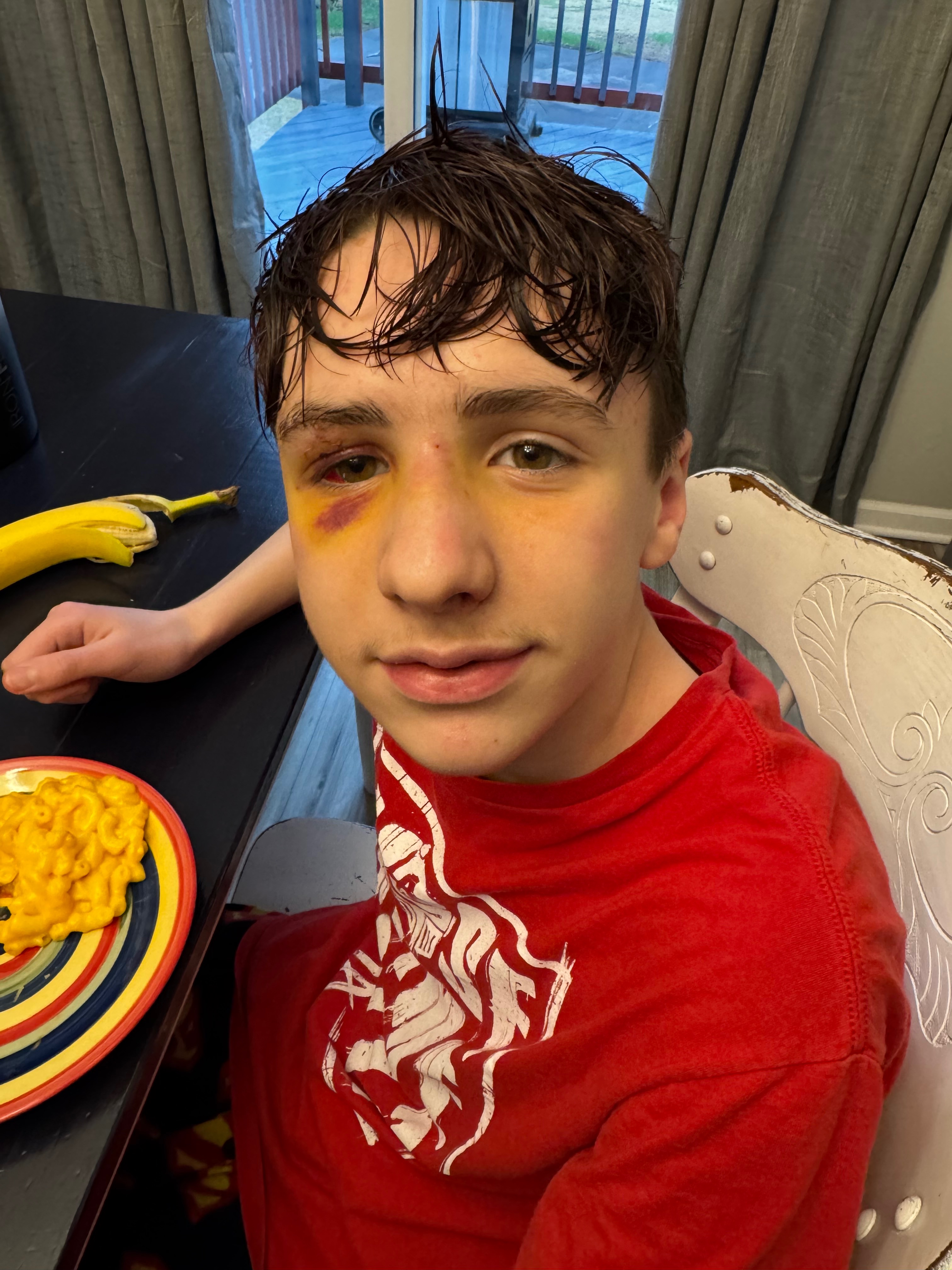 Support Liam's Fight Against Epilepsy campaign photo, 4 of 7
