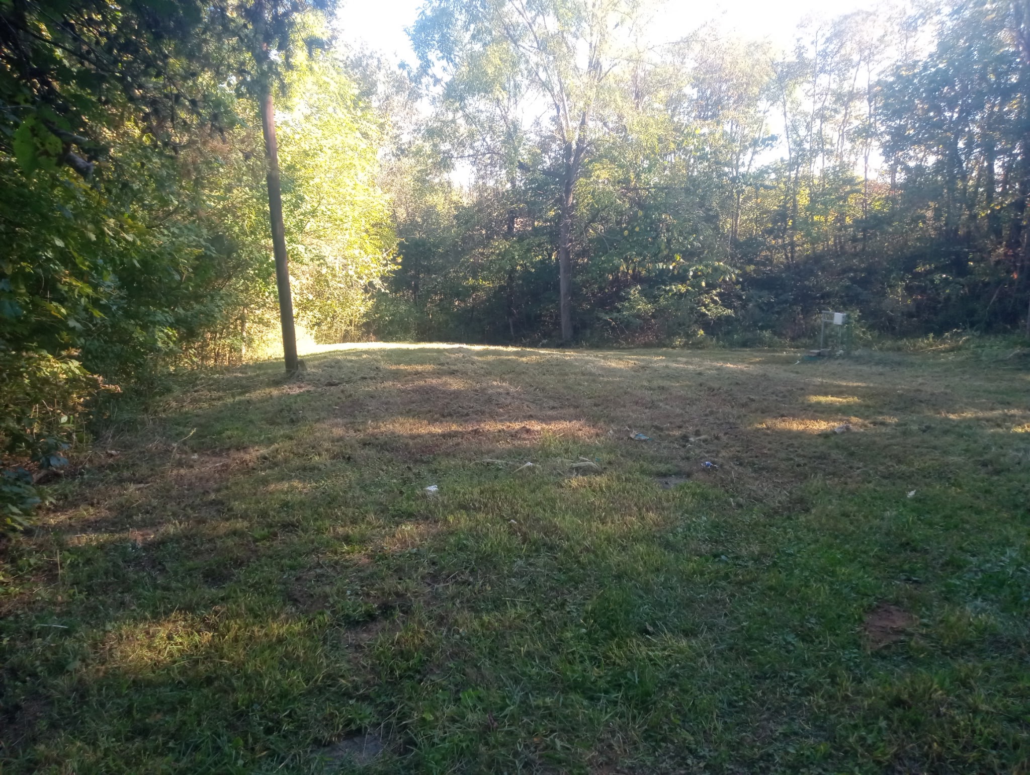 John's Progress after his fire .  BEFORE & AFTER Pictures!! campaign photo, 2 of 6
