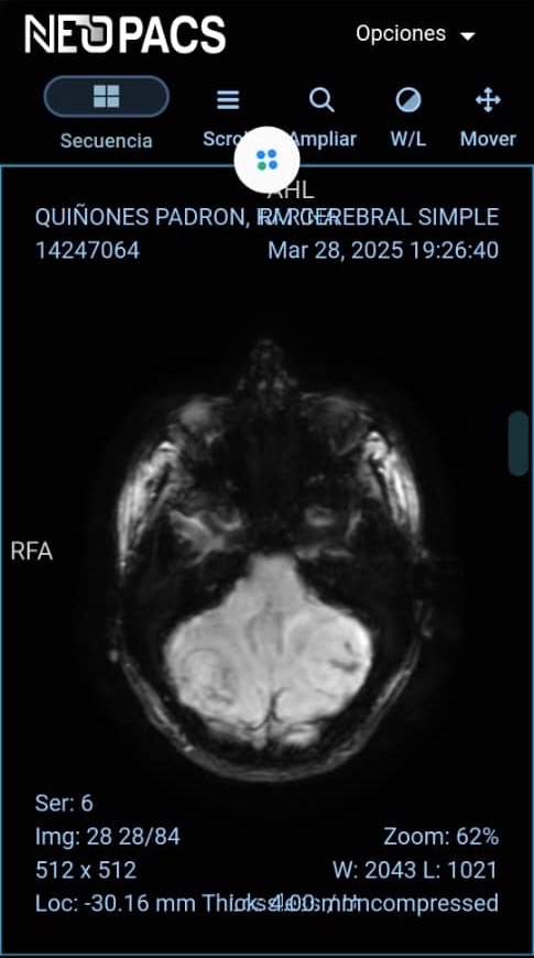 Operación de meningioma campaign photo, 7 of 8
