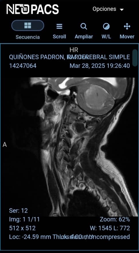Operación de meningioma campaign photo, 2 of 8
