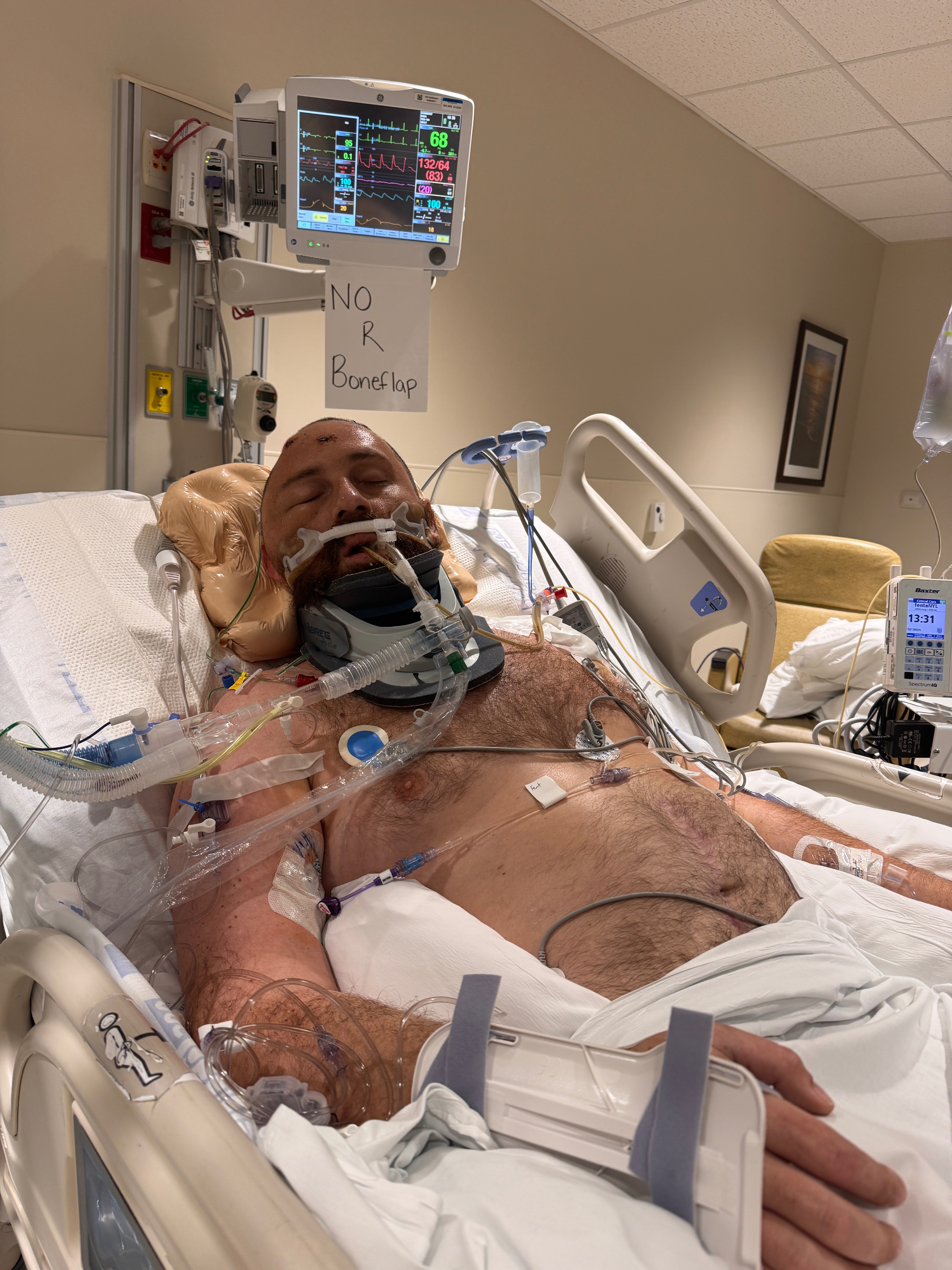 Help Dana Scarberry in his recovery and rebuilding his life campaign photo, 7 of 8