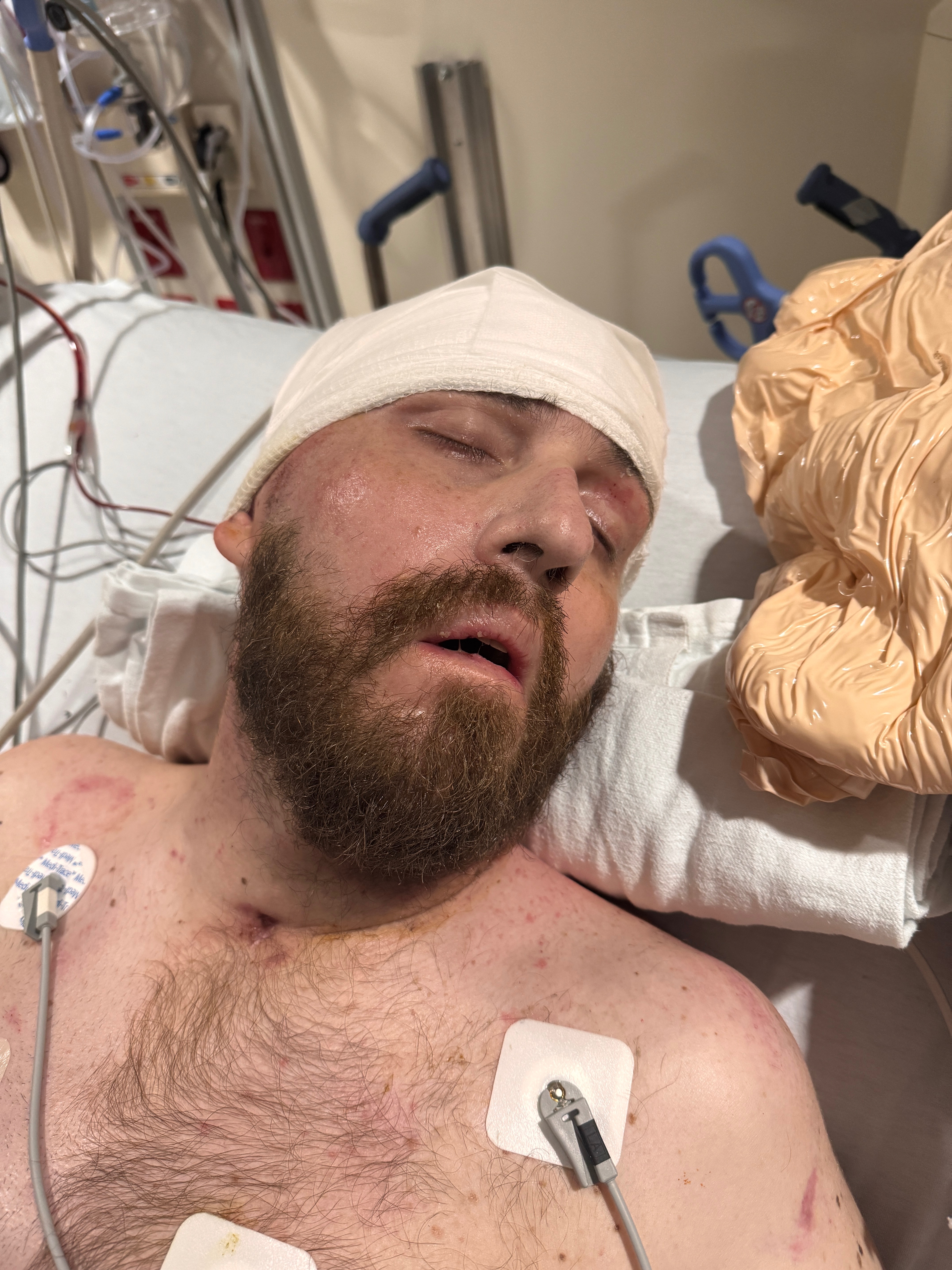 Help Dana Scarberry in his recovery and rebuilding his life campaign photo, 4 of 8