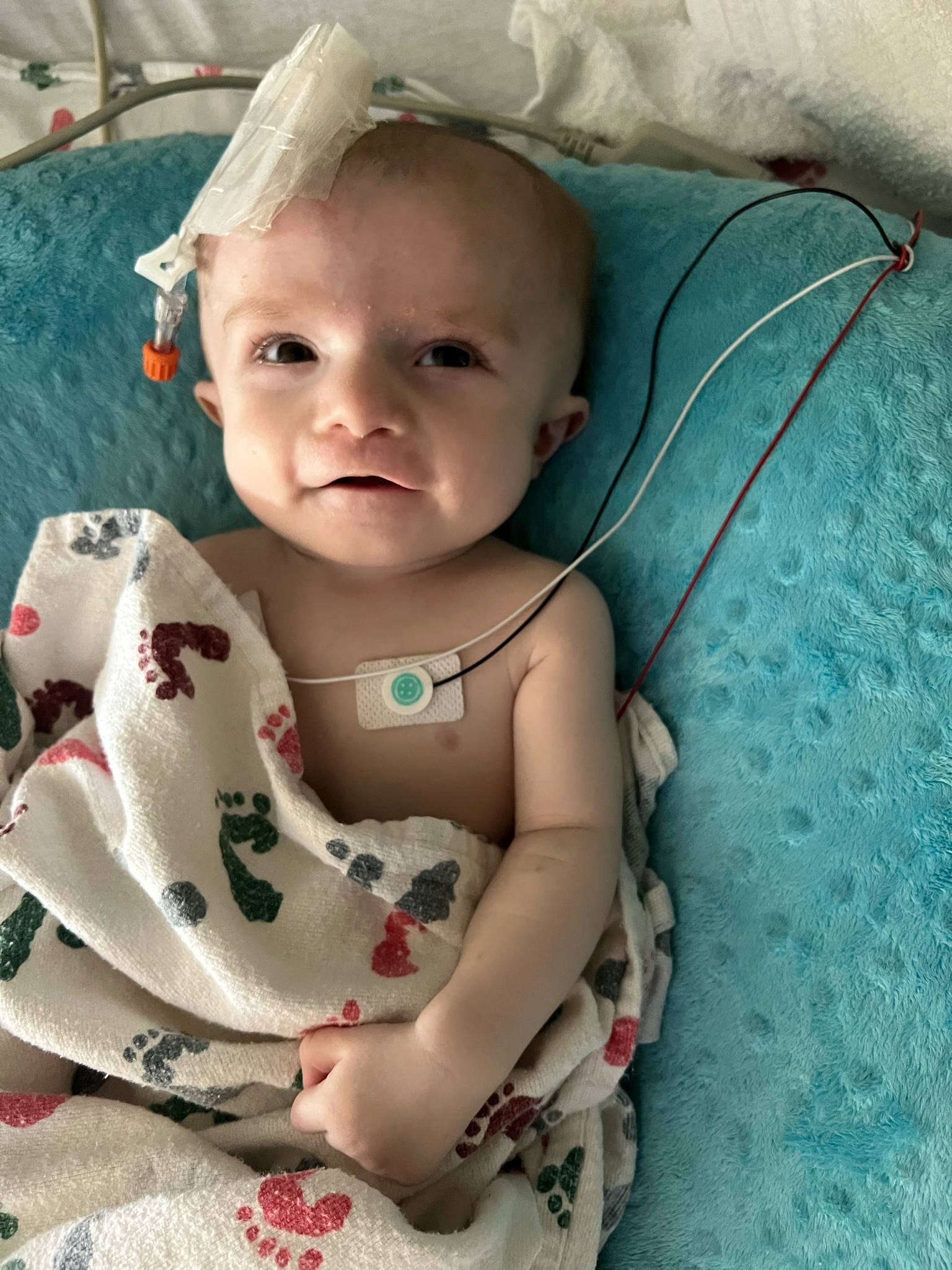 Help for 5 month old Hayes Hogan and his open heart surgery! campaign photo, 2 of 3