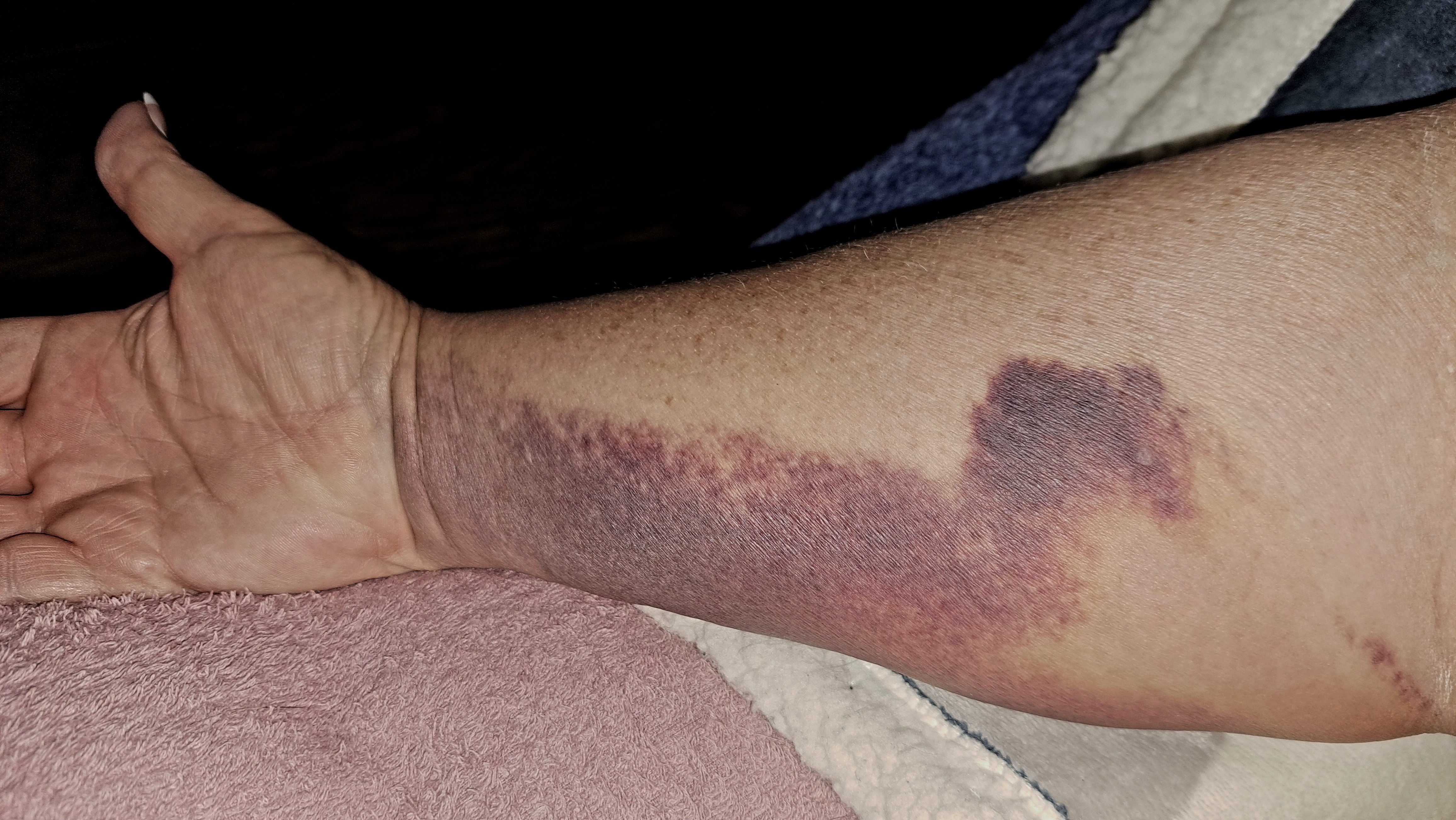 Sherri Needs Aid: Medical and Home Crisis campaign photo, 5 of 7