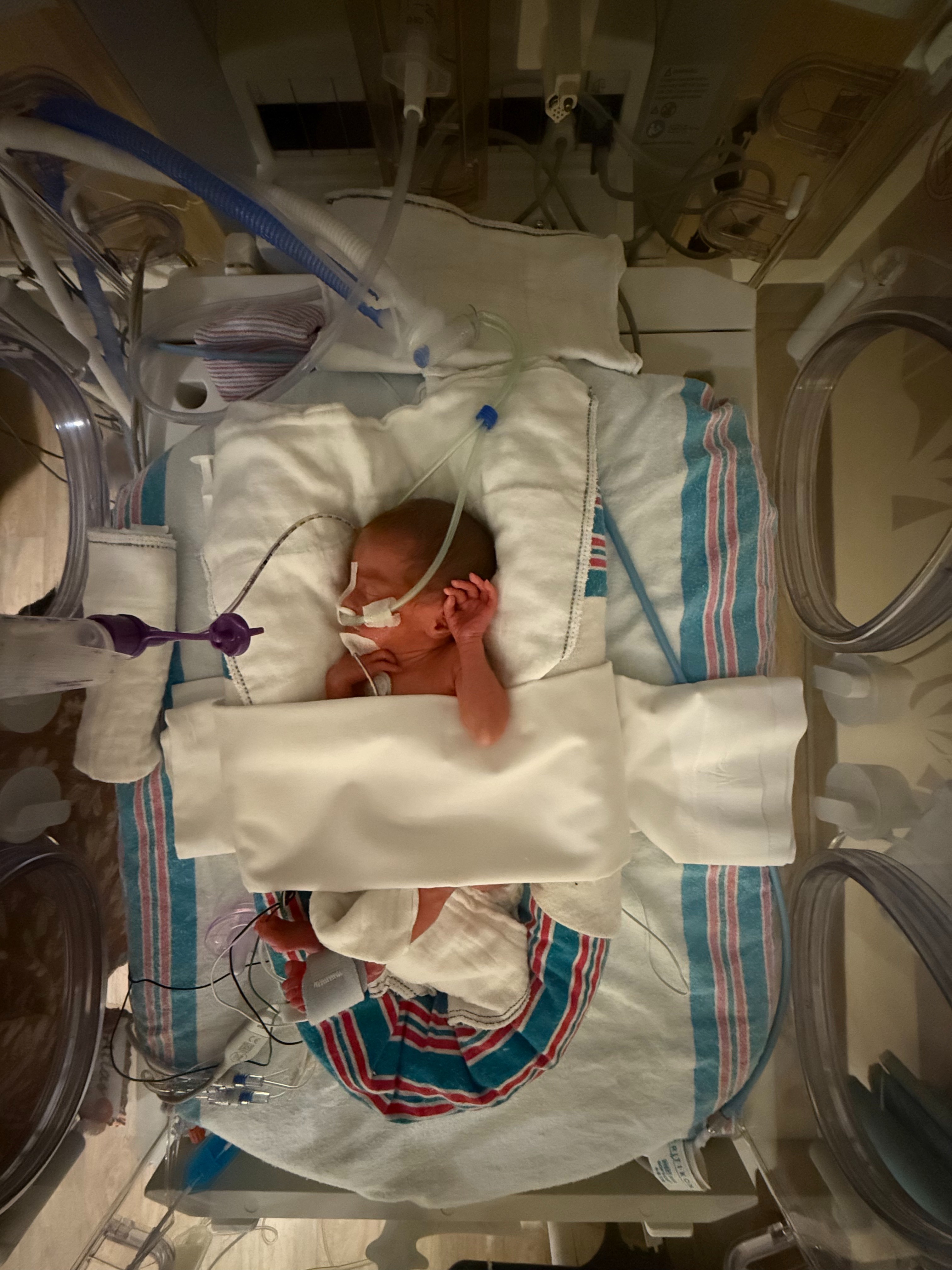 Ronelle's Baby Atlas Needs Our Support campaign photo, 4 of 8